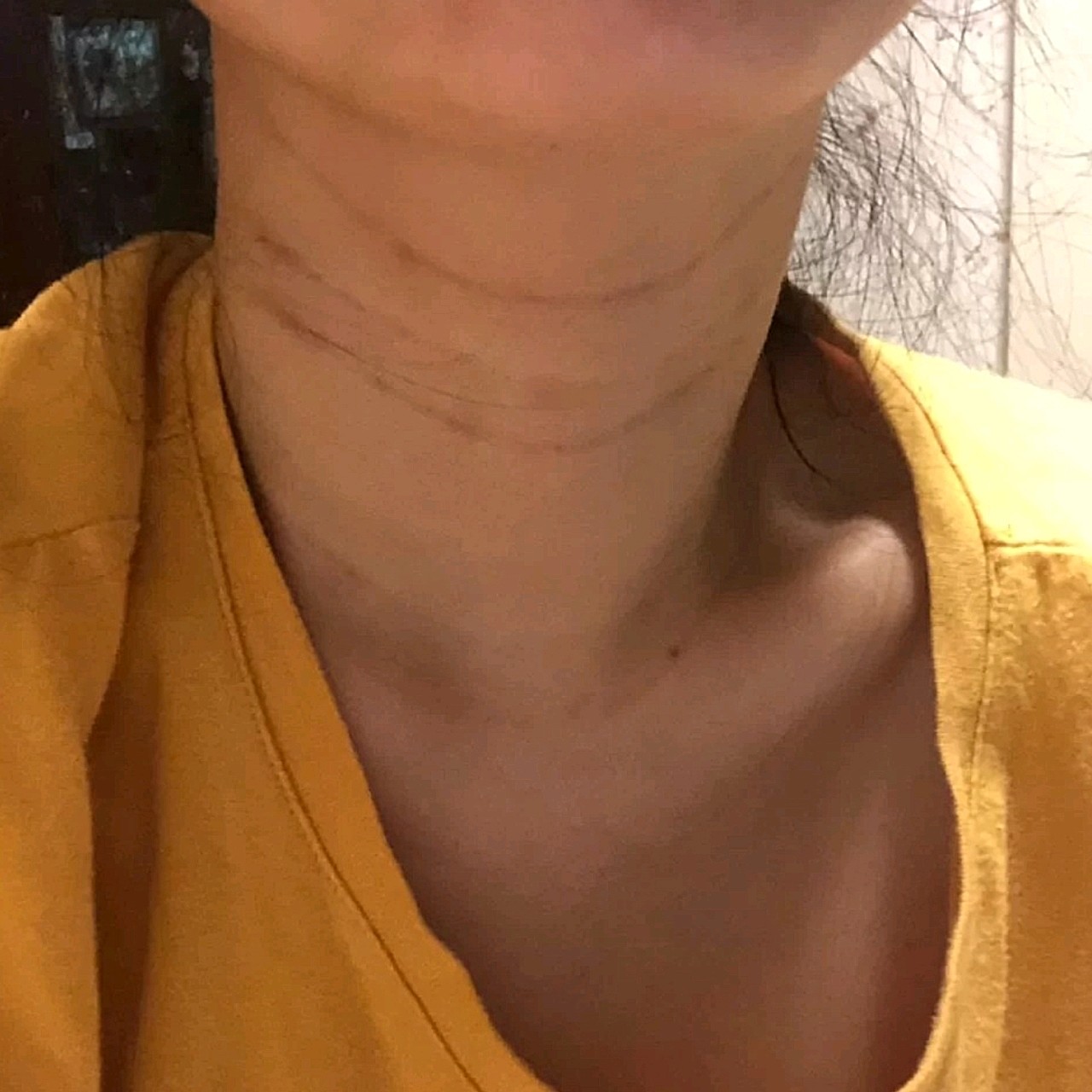 这里先说明一下,我的颈纹是天生的.以前到也没觉得什么,有就有吧.