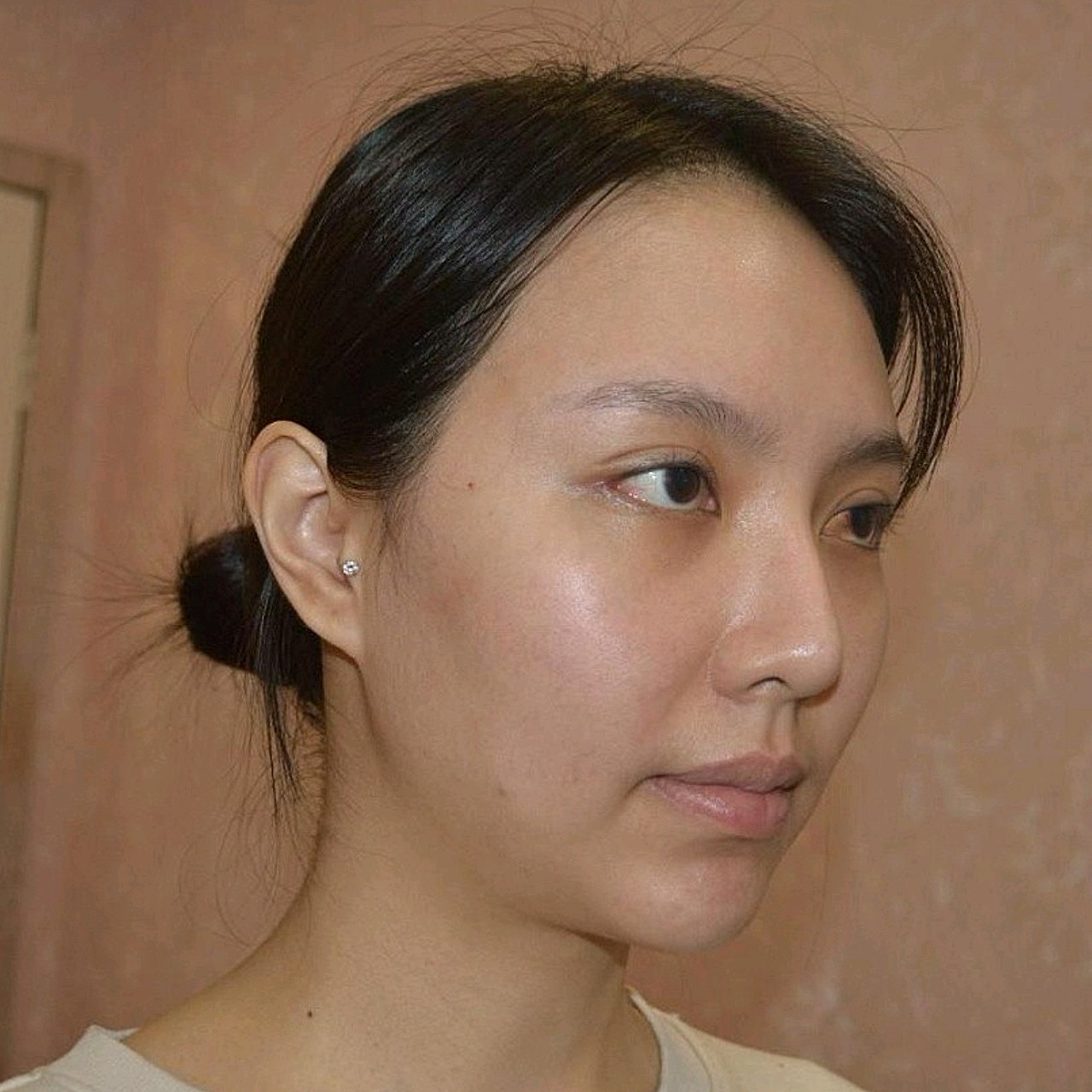 我脸上肌肤虽然说正面看没有很明显的松弛,但是侧面看_圈子-新氧美容