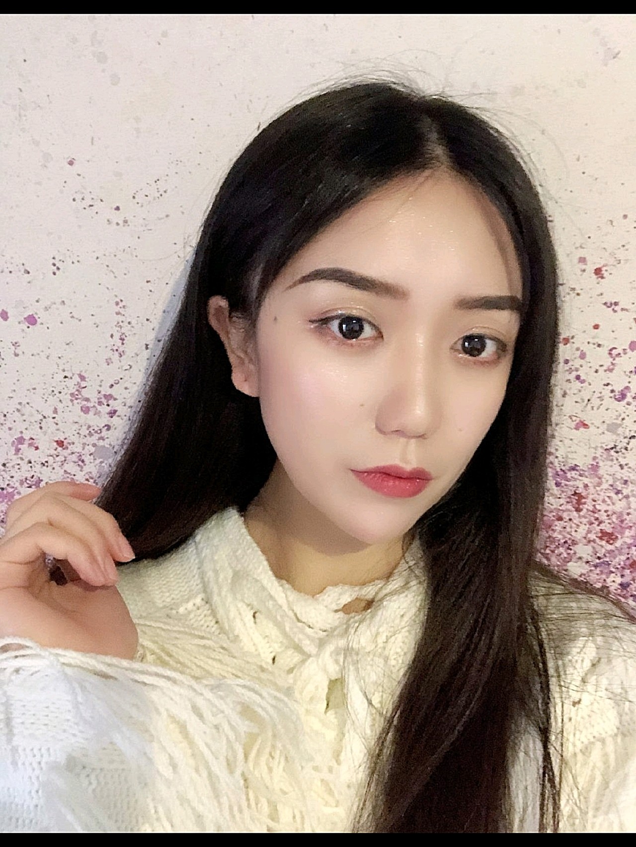 我就是一个典型的肉肉脸,脸颊,面颊脂肪偏多,显得整_圈子-新氧美容