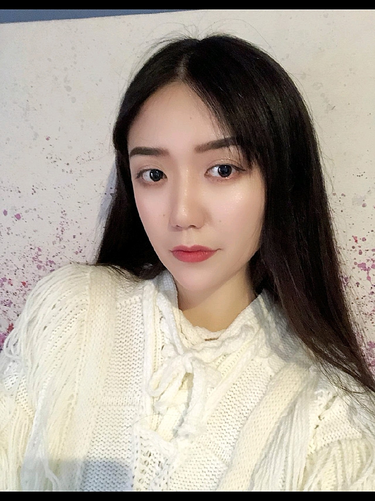 我就是一个典型的肉肉脸,脸颊,面颊脂肪偏多,显得整_圈子-新氧美容