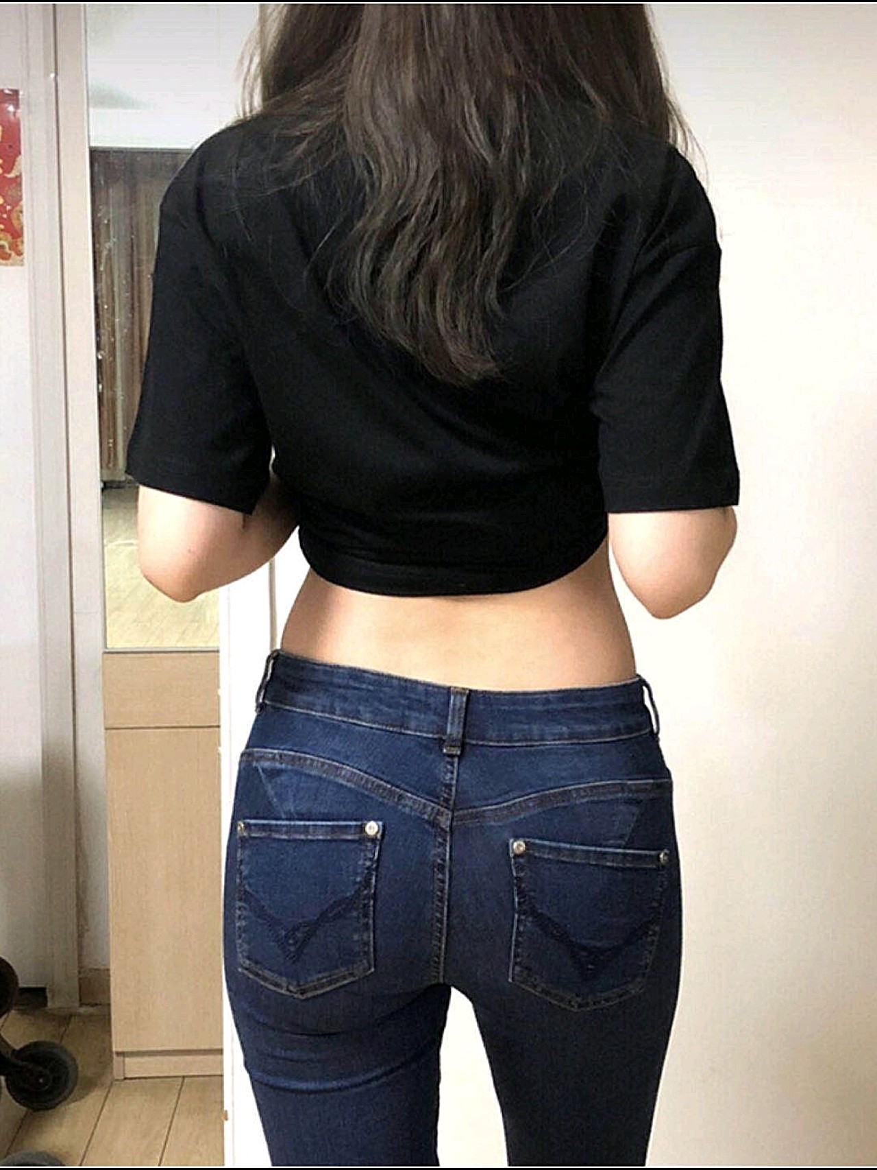 腰腹吸脂 丰臀一起做的,一点儿都没有浪费~03水桶腰_圈子-新氧美容