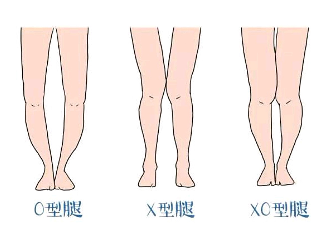 不同腿型图片