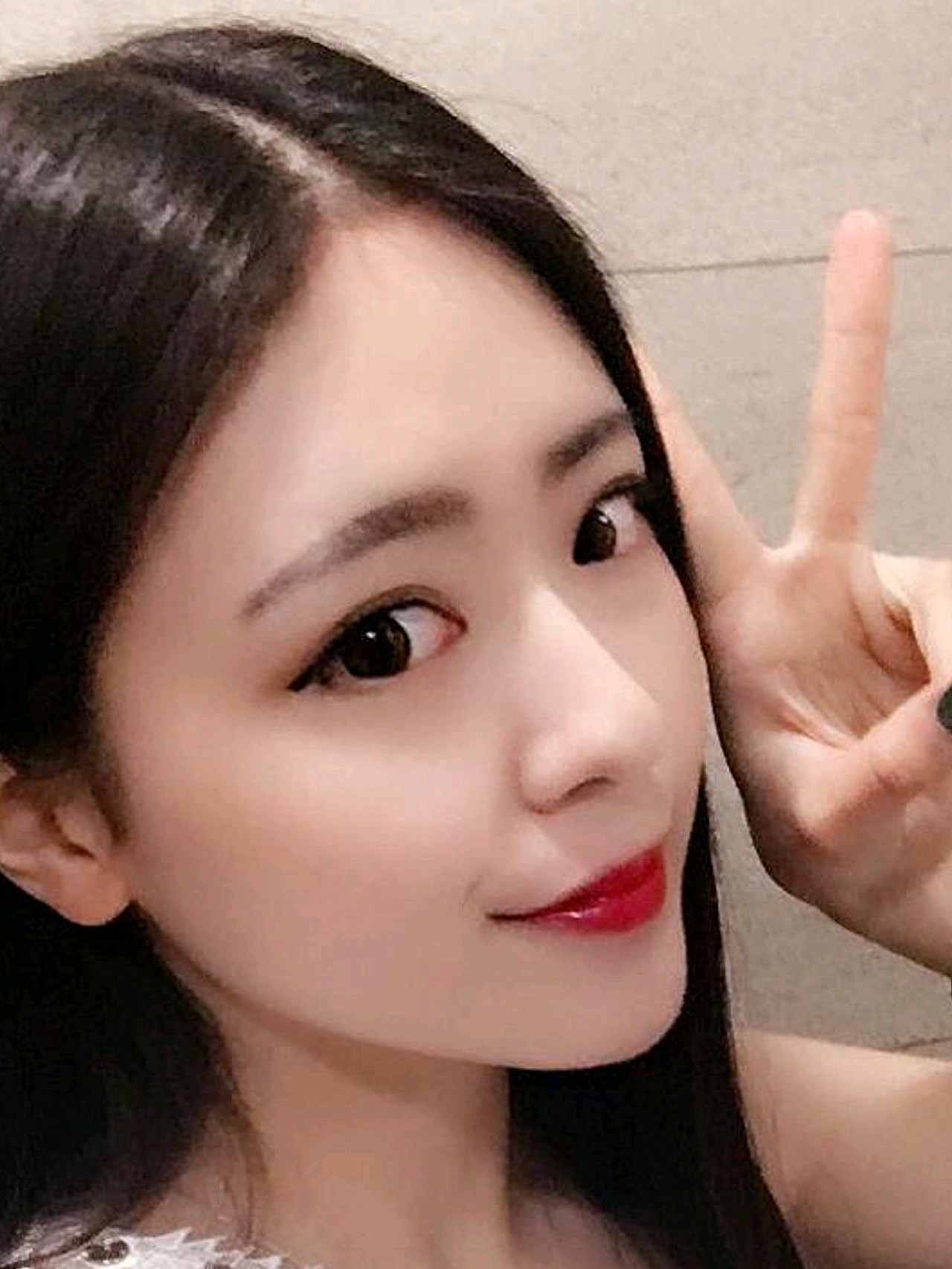 自从做了鼻子,我觉得自己的气质真是直线上升,气质这_圈子-新氧美容