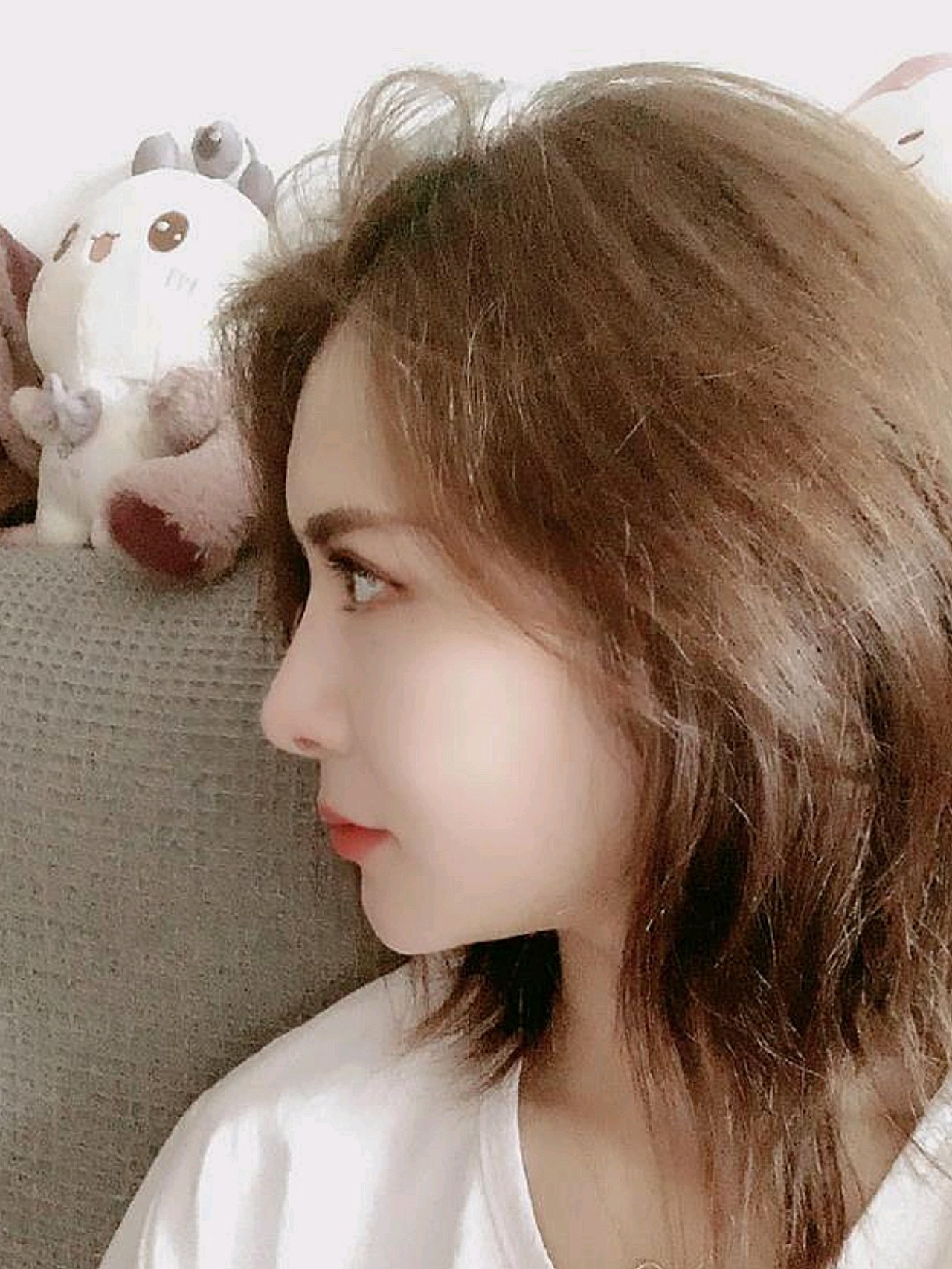 方案:膨体 肋骨鼻部多项 鼻头很漂亮,鼻梁挺拔,鼻翼_圈子-新氧美容