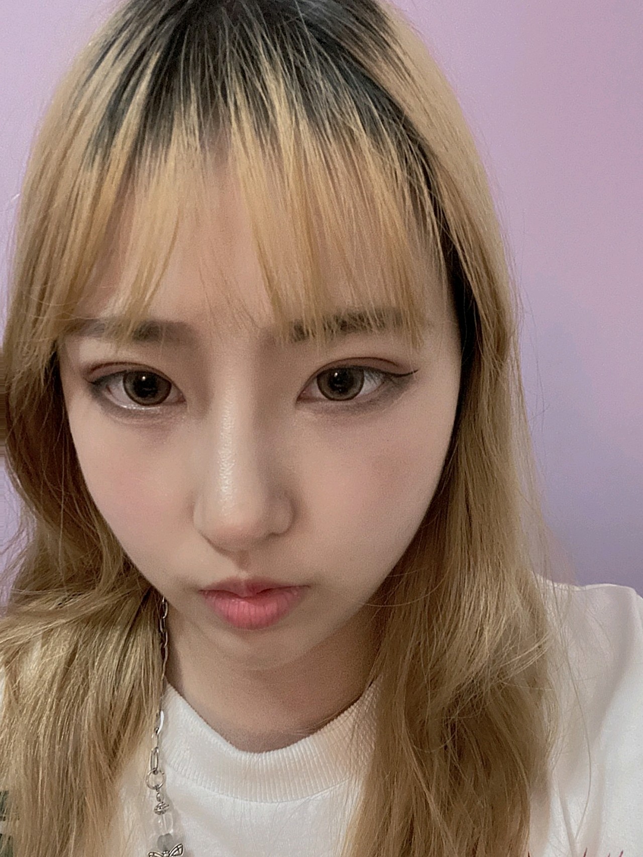 丹凤眼双眼皮 高挺小翘鼻,终于是我的标配了,好开心_圈子-新氧美容