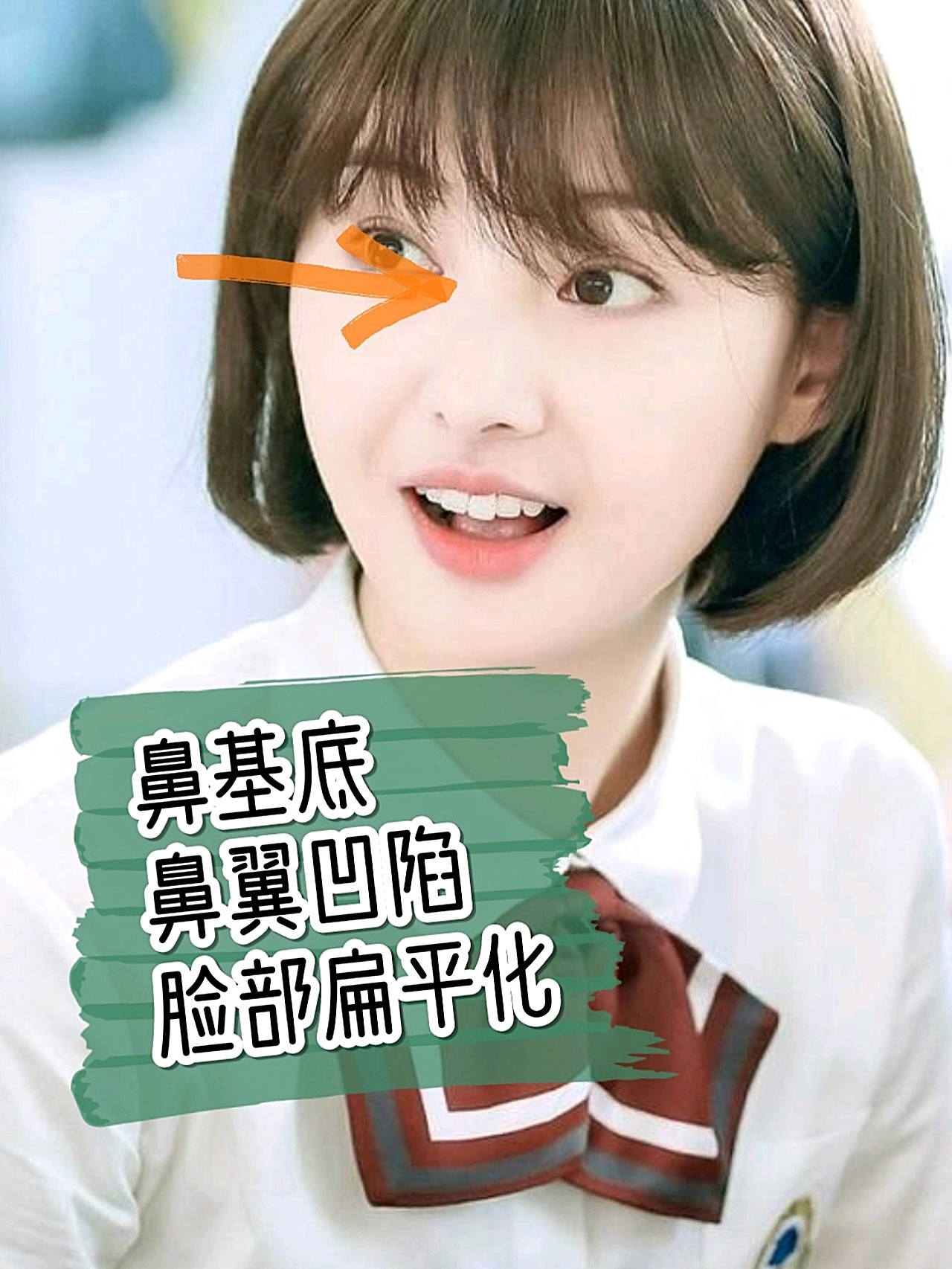 一起来看流星雨的楚雨荨应该是郑爽的颜值巅峰了吧,不_圈子-新氧美容