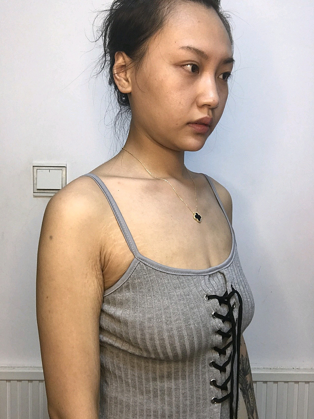 现在的照片是我之前没有做项目的样子,哪个时候胸部有_圈子-新氧美容