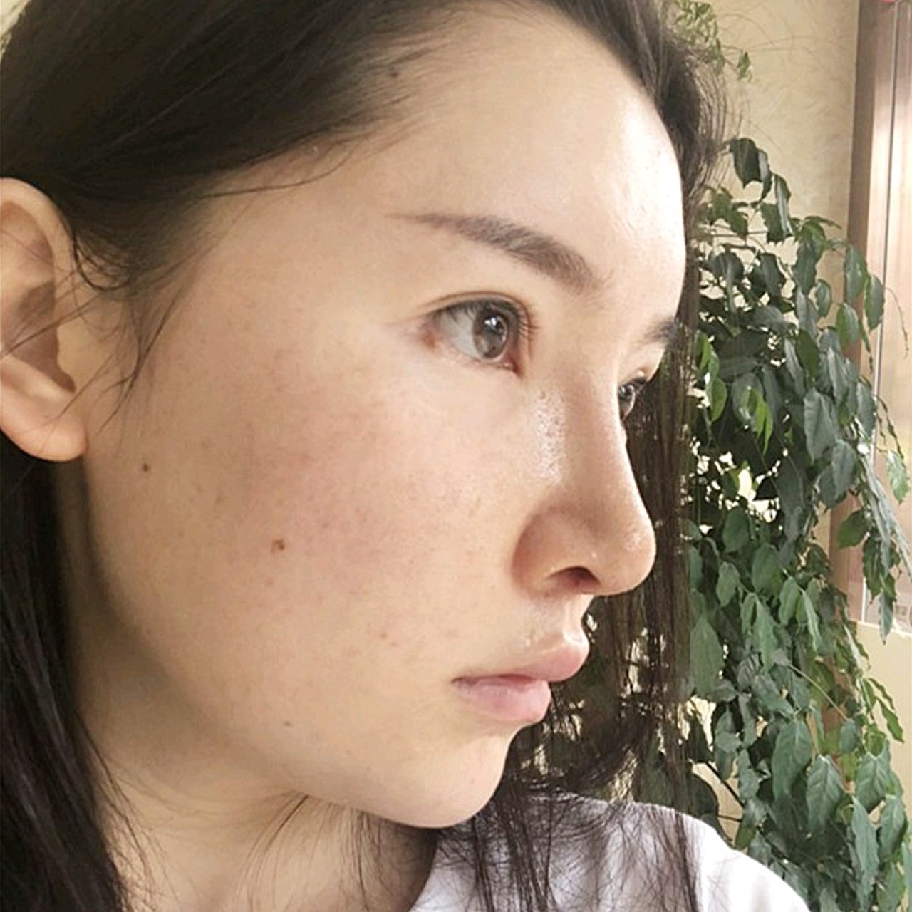 很早的时候就知道自己鼻子的缺陷了,鼻梁很低正面观察_圈子-新氧美容