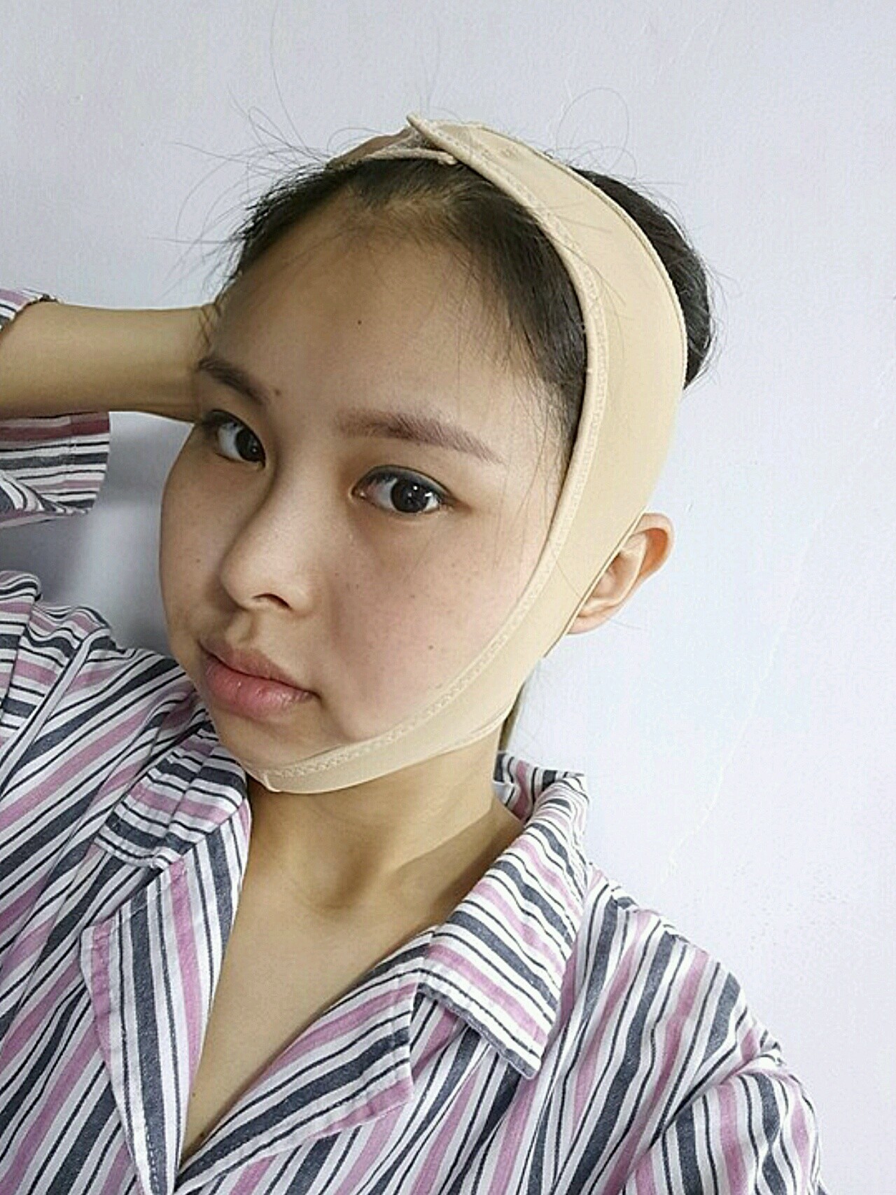 【颌面手术第2天】