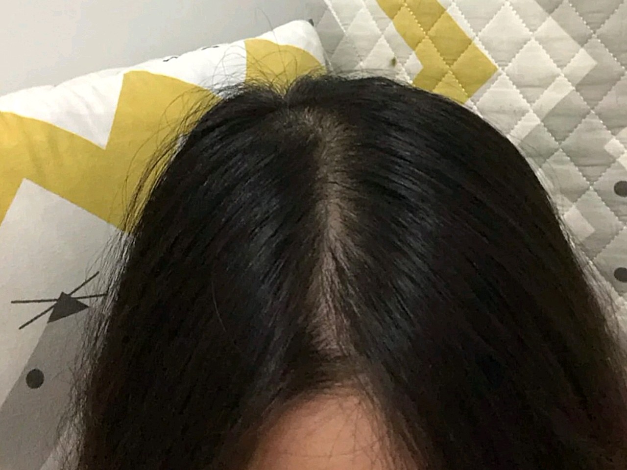 成功解决了发缝稀疏的问题