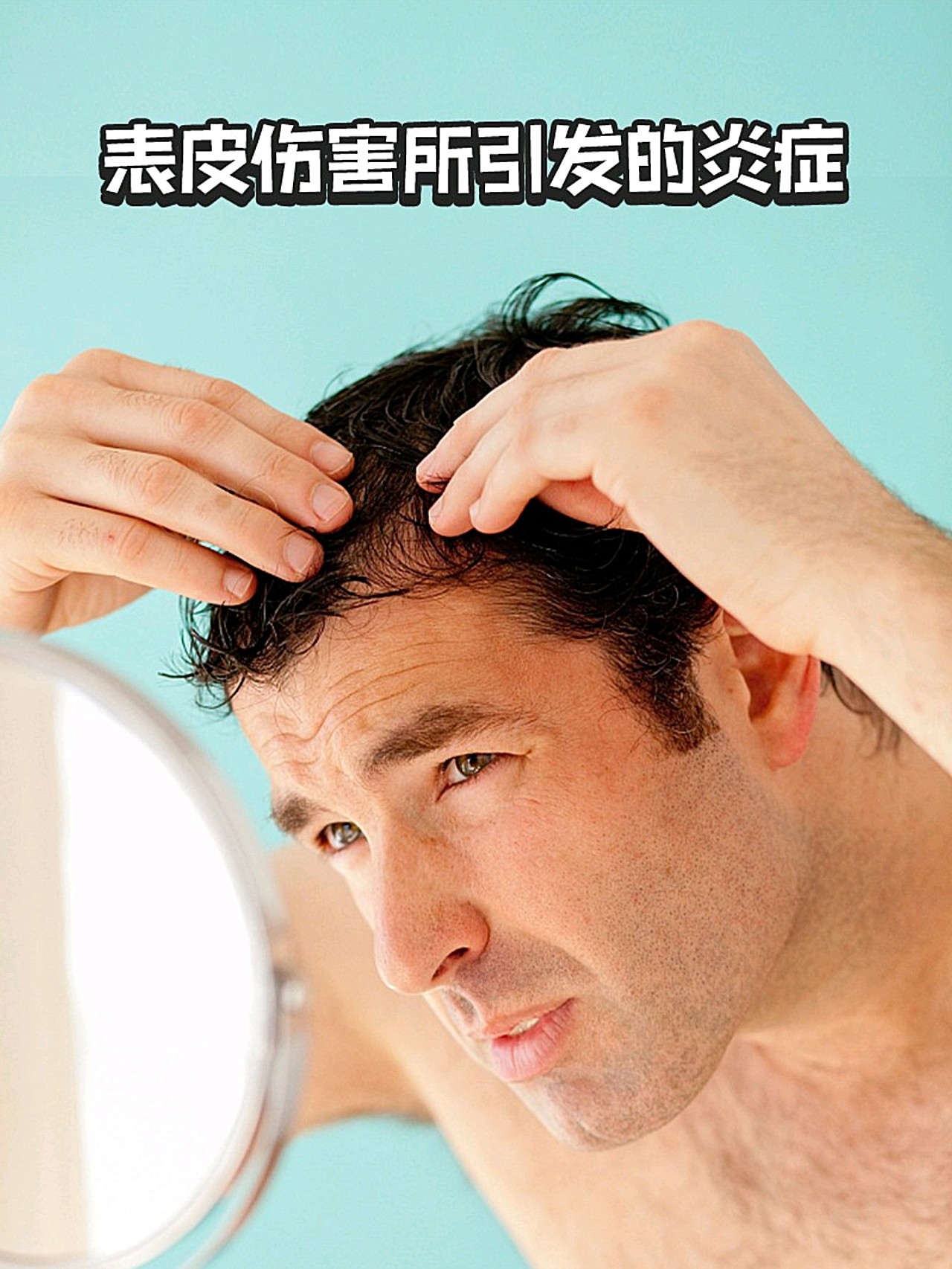 脂溢性脱发可以有什么解决方法呢？ - 知乎