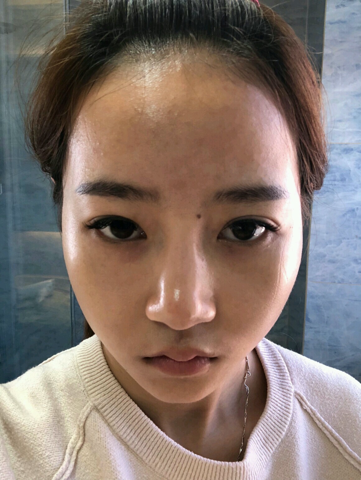 鼻翼宽山根平坦鼻头圆钝鼻梁塌