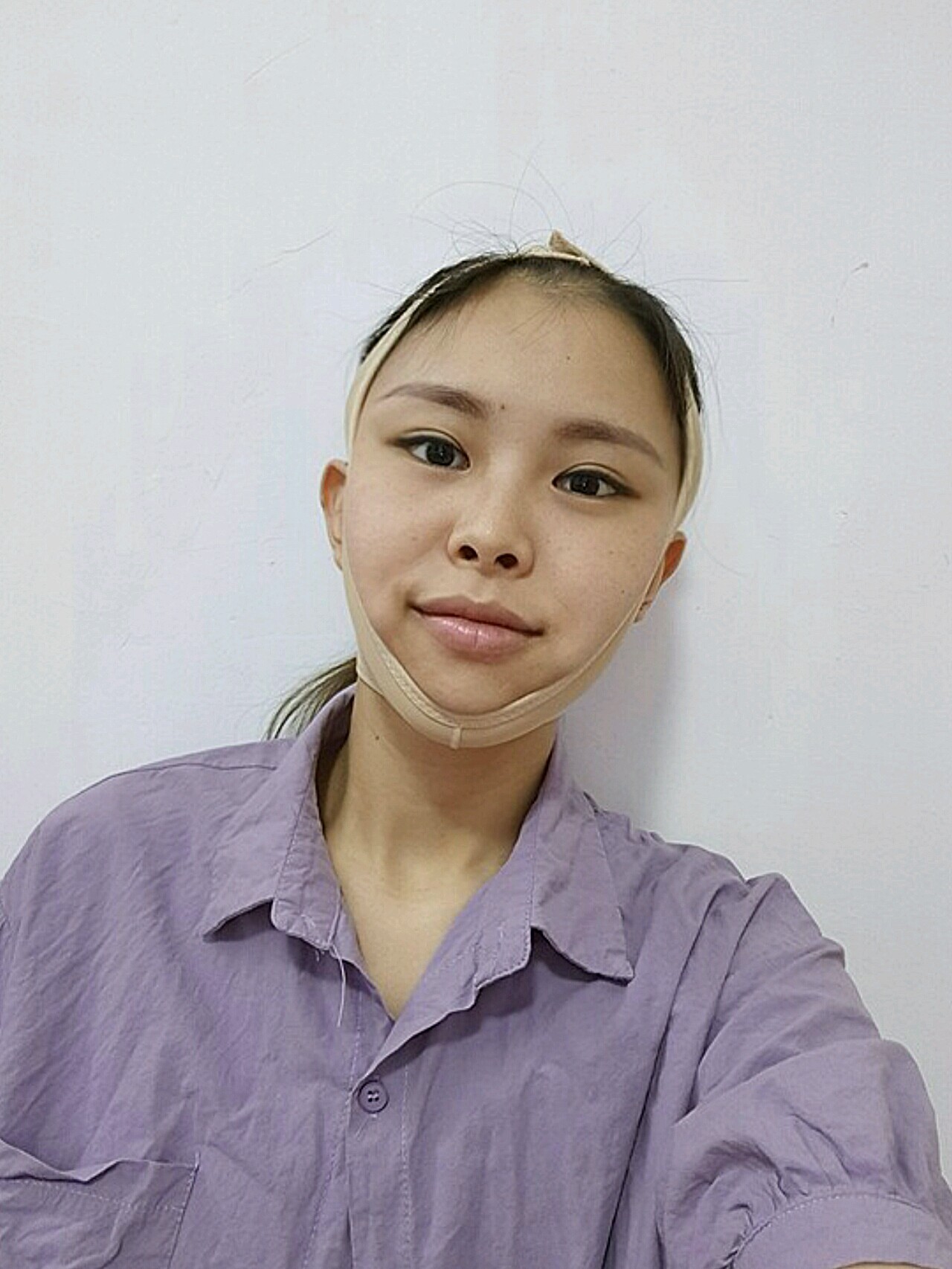 【颌面手术第6天】