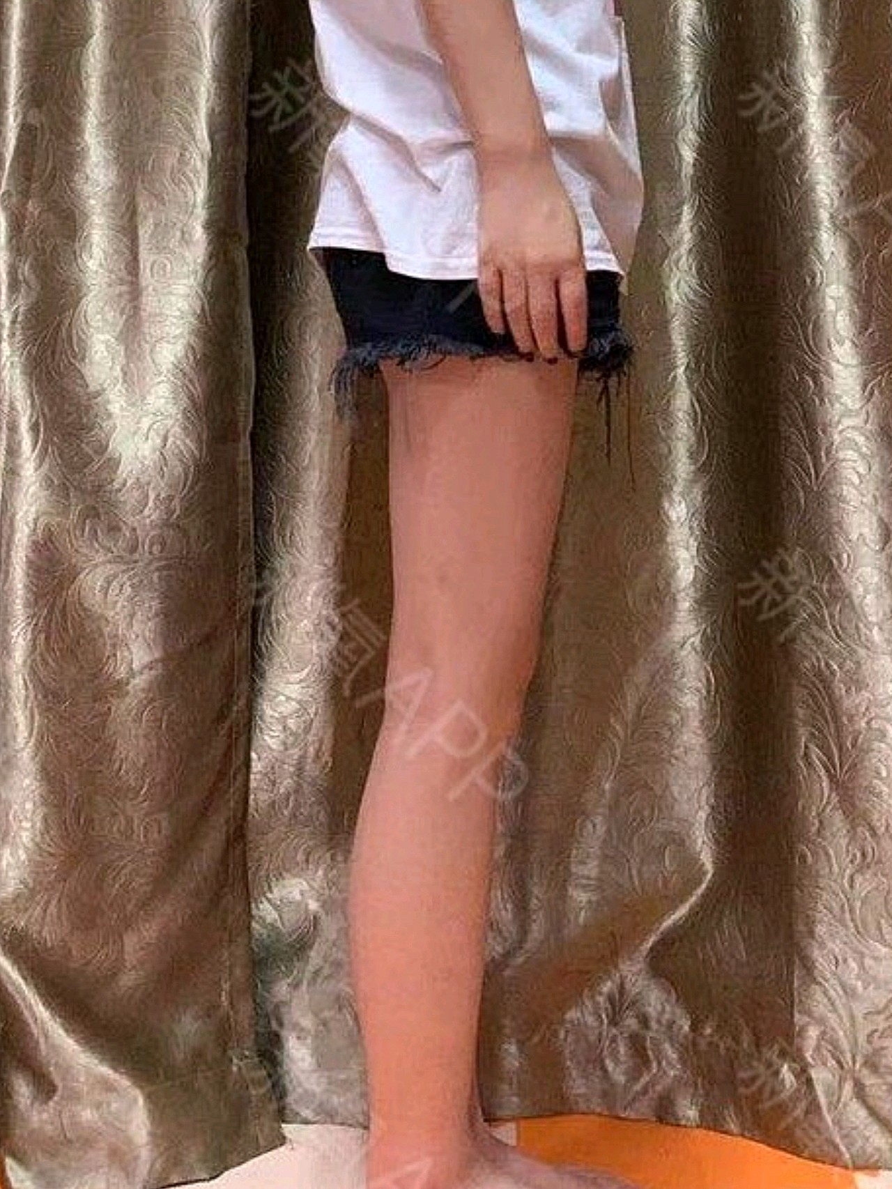 一直都觉得大腿粗,尤其是看到朋友圈看那么多晒大长腿_圈子-新氧美容