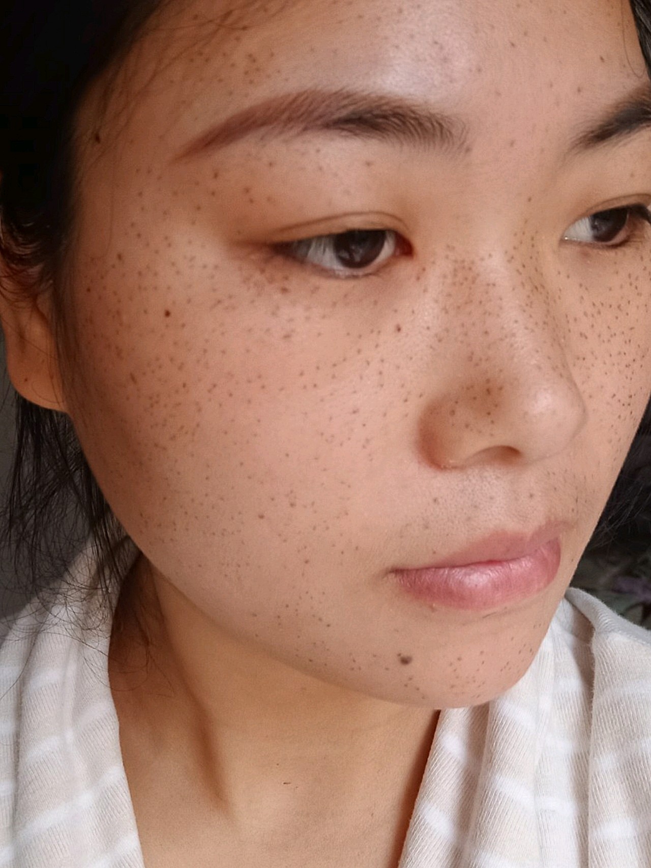 祛斑第四天,脸斑点还是很黑,期待效果