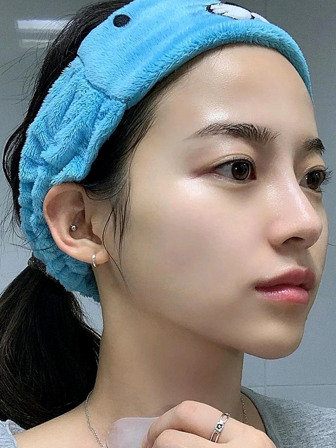 大家只看鼻子是不是觉得现在恢复得超级自然了,我是超喜欢这种鼻型的