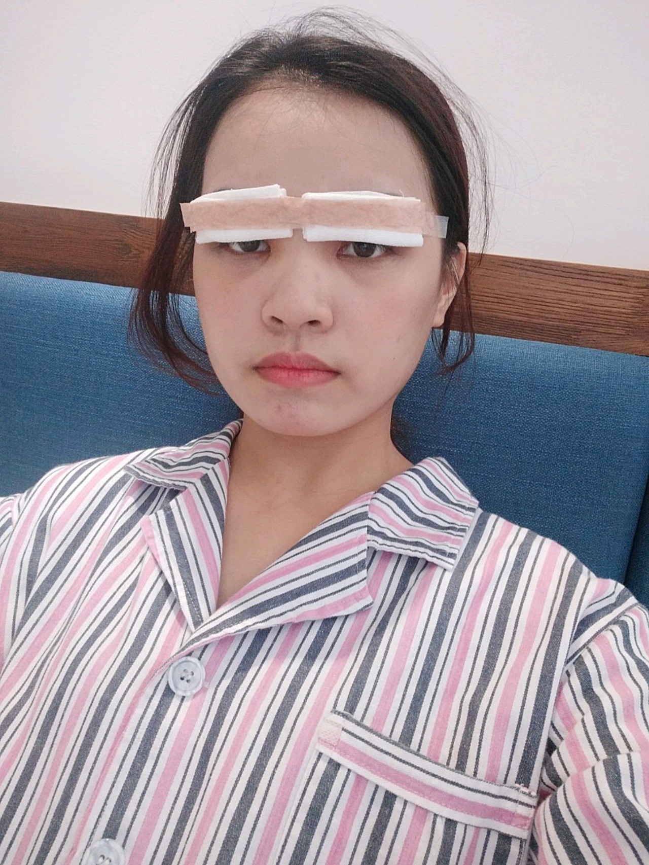 【罗氏双眼皮多项手术第一天】我在新氧医美关注琢悦很_圈子-新氧美容