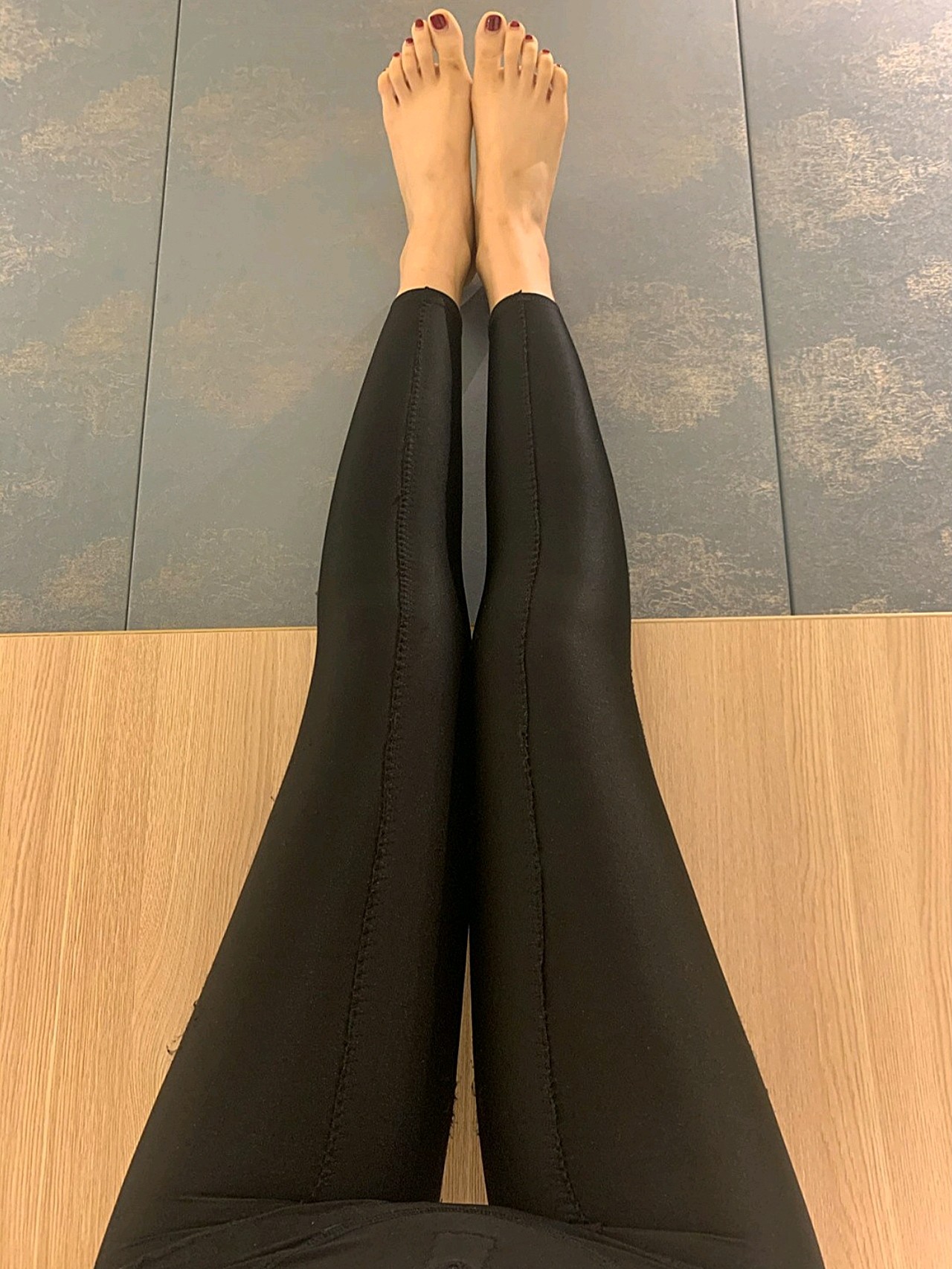大小腿环吸吸脂手术day13大腿:50小腿:34昨_圈子-新氧美容整形
