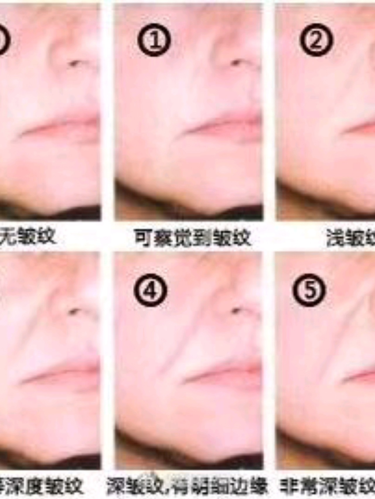 【你的法令纹是几级?】