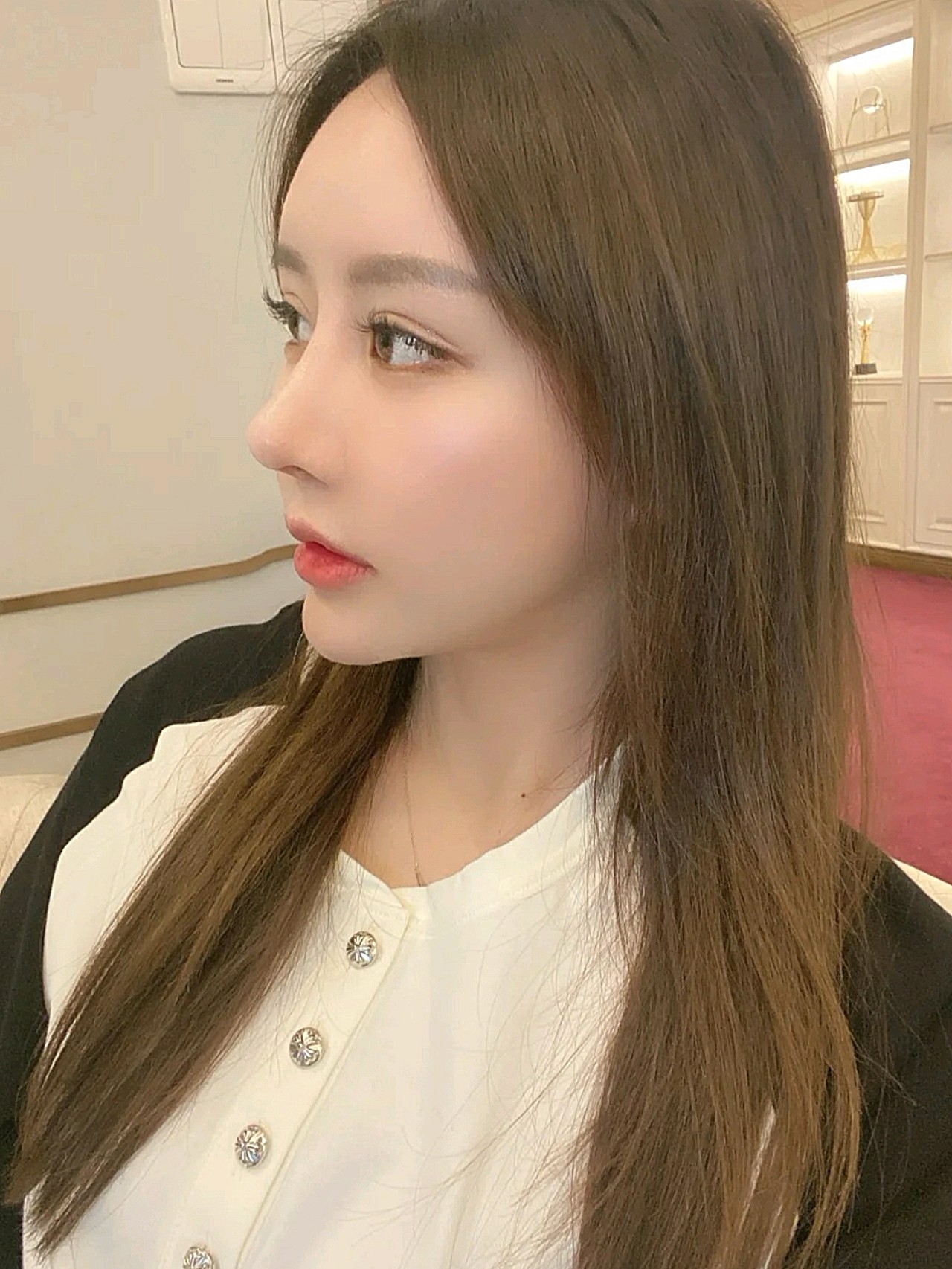 都说我这次鼻修复的比上一次来说自然太多了,心_圈子-新氧美容整形