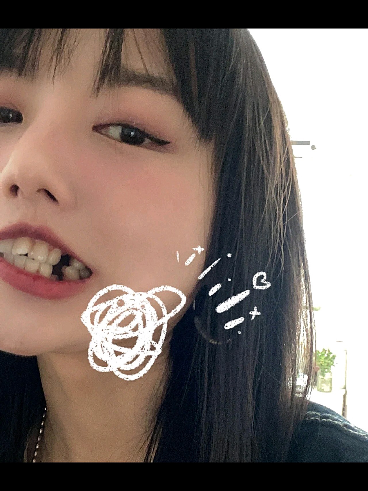 就被忽悠的没想矫正.直到10年前想做矫正了,因为要拔牙一直纠结.