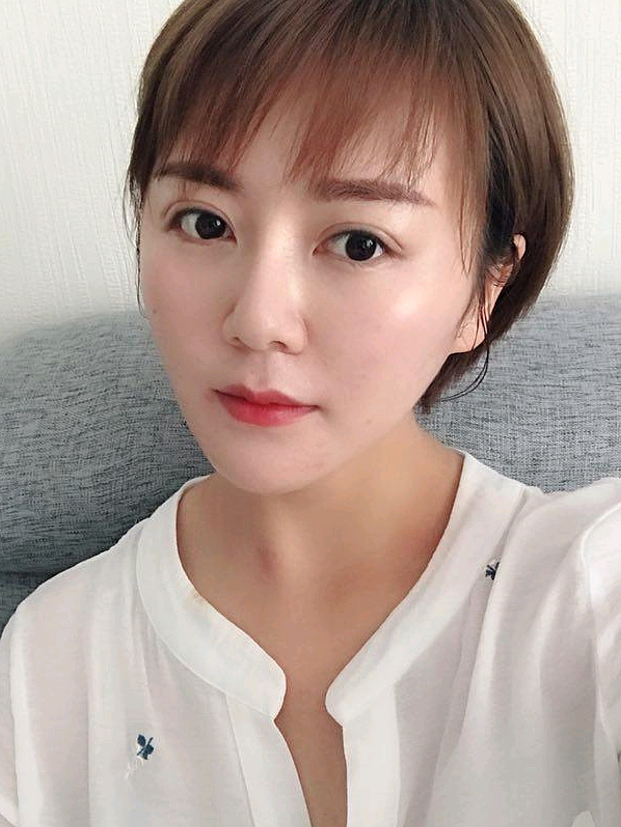 做了6次光子嫩肤,终于拥有无暇肌了!