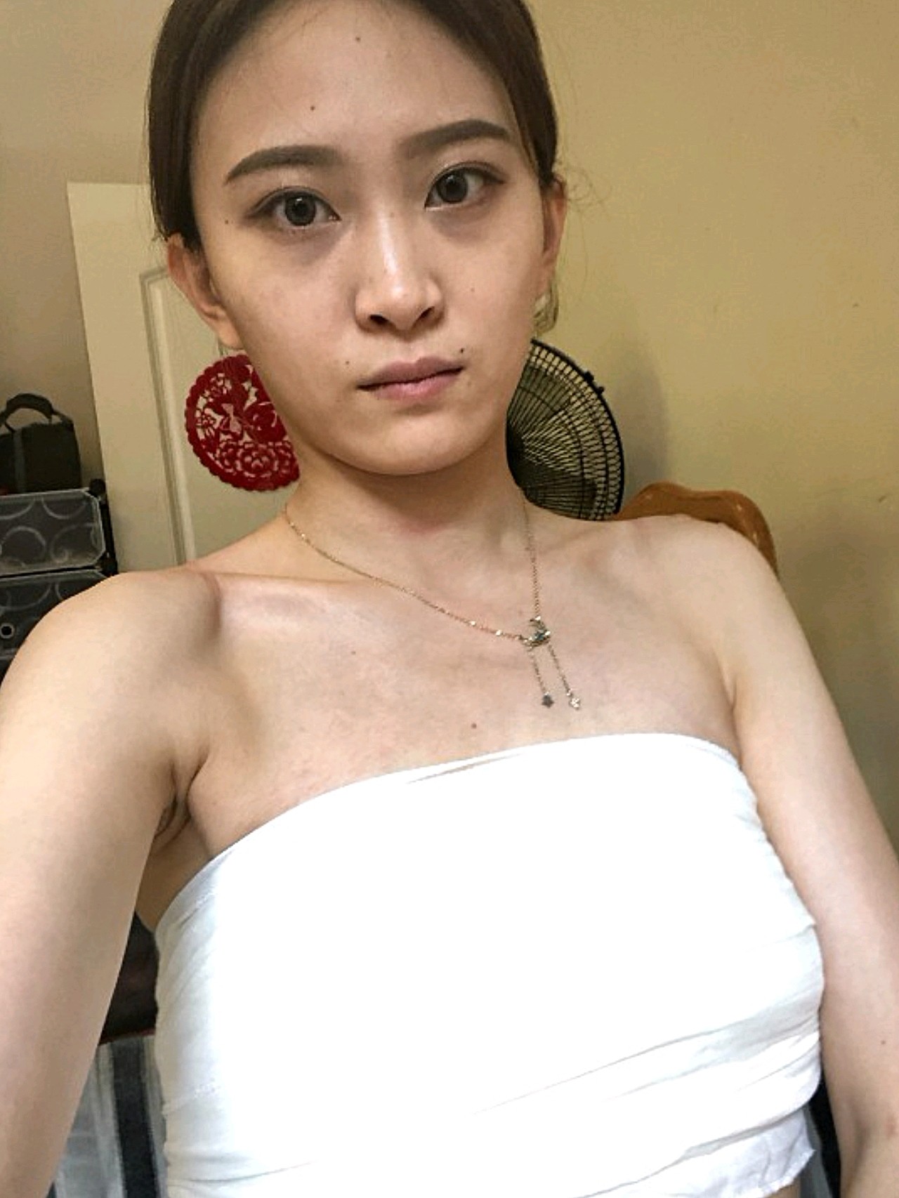 术后 第1天