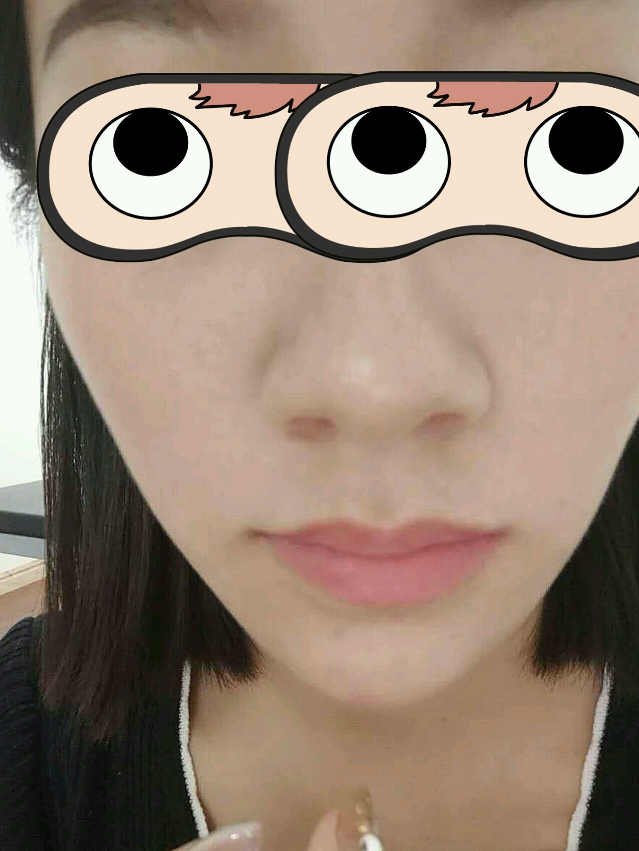 陈院长推荐我做了内切缩鼻翼,给大家看看效果,疼痛嘛_圈子-新氧美容