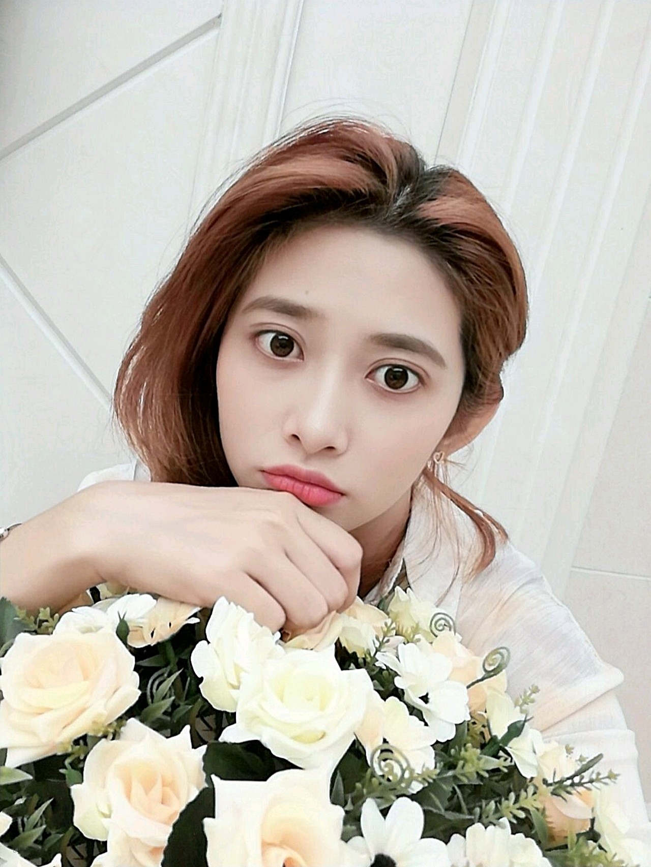 【罗氏双眼皮多项手术第7天】今天也依然是一个素颜女孩,已经