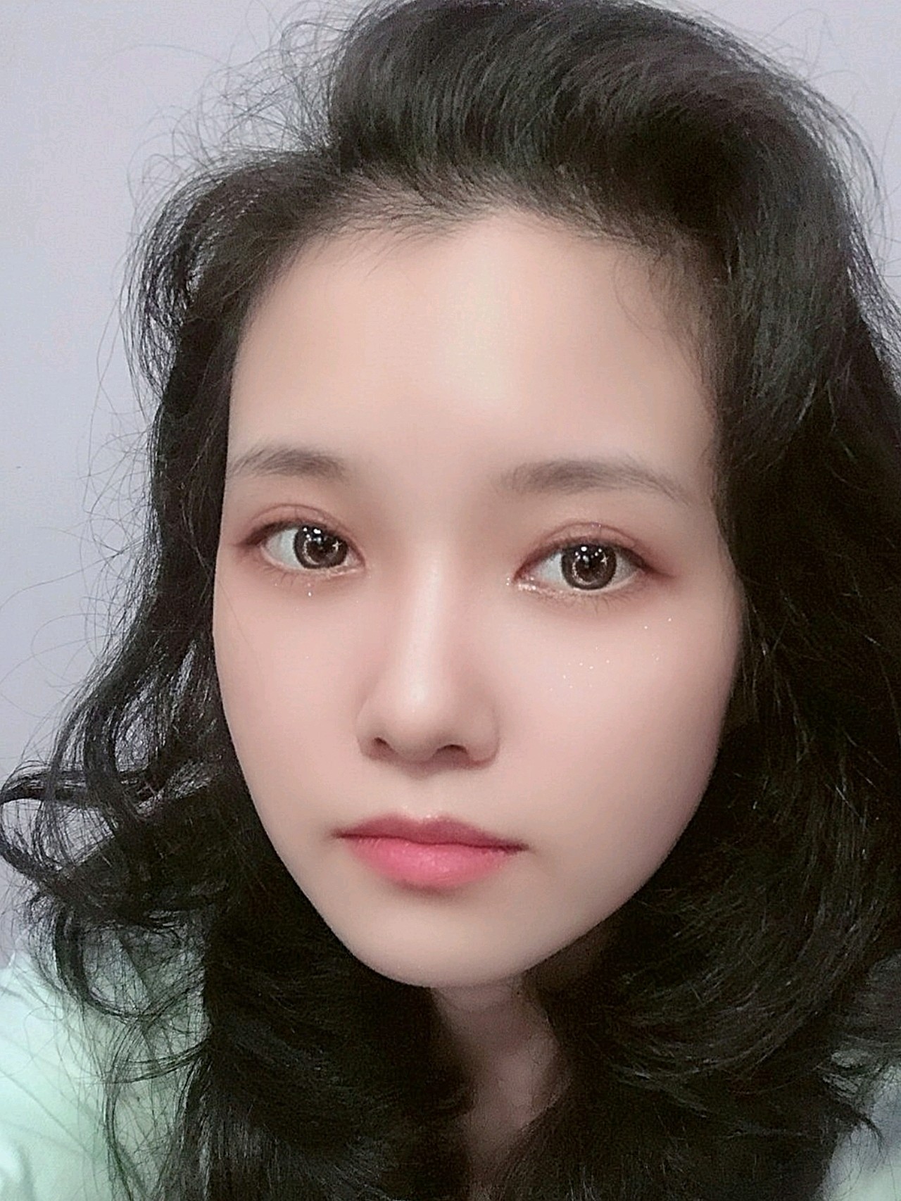 【雷氏精雕双眼皮术后20天】宝宝们,我又来更新了,_圈子-新氧美容整形