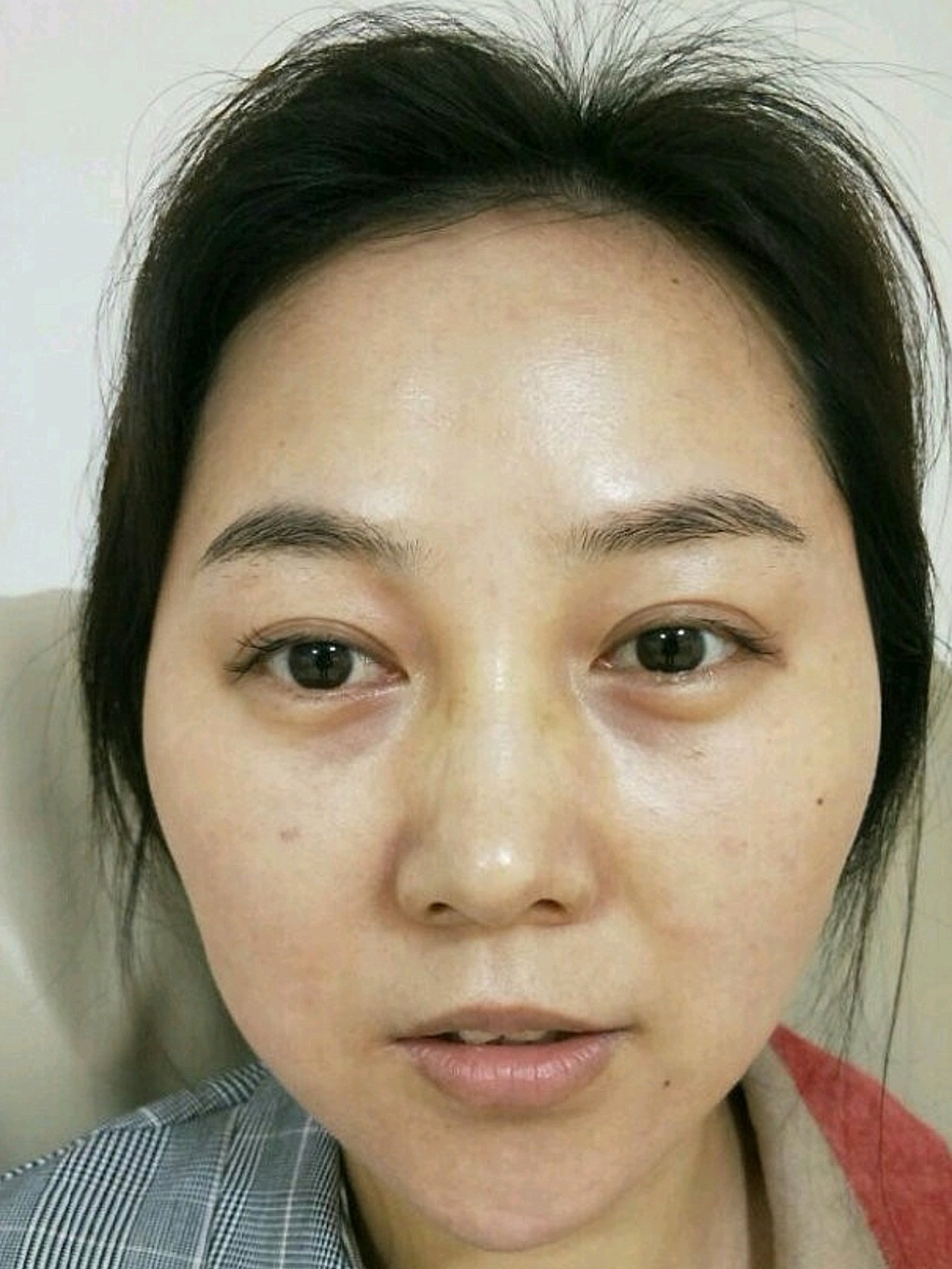 脸大的原因大部分都是因为脸上脂肪太多,而且老了还容_圈子-新氧美容