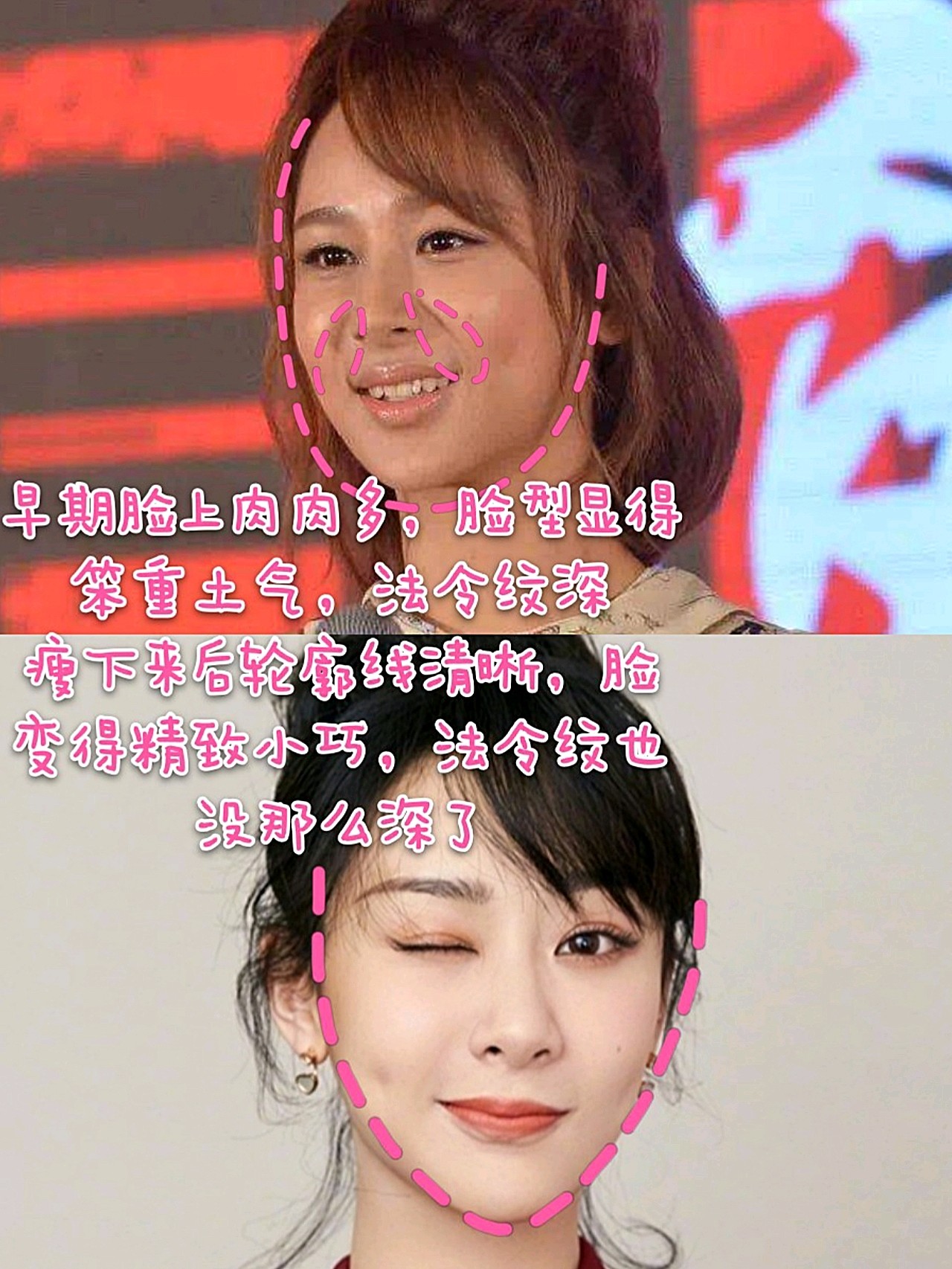 苹果肌优生代表杨紫