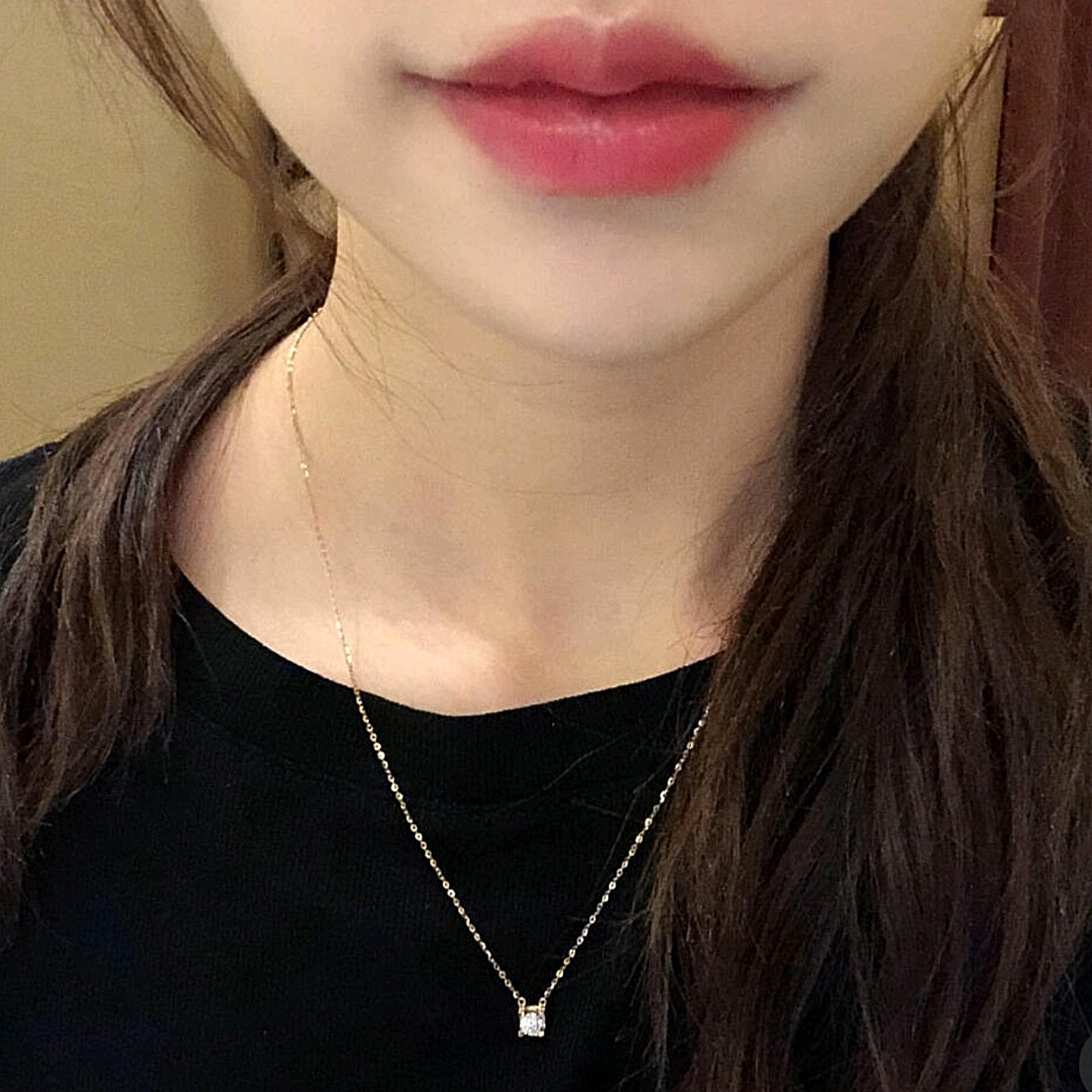 最近看小姐姐们关注最多就是微笑唇m唇手术后留疤的问题,简单说下我的