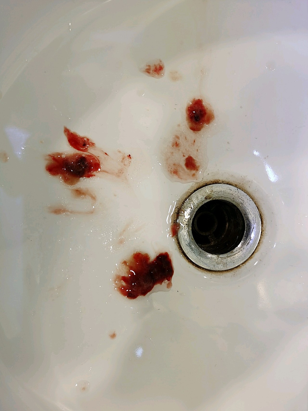 特别不通气的时候能咳出血痰.