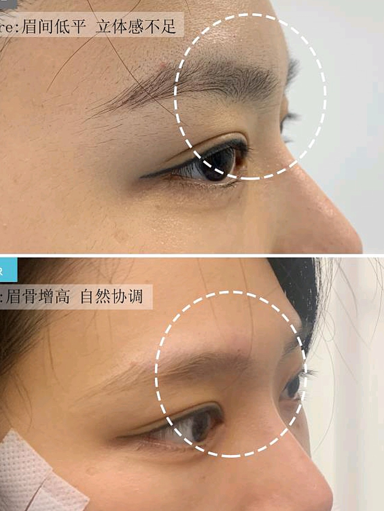 怎样从7分美女进阶到9分 今天要 圈子 新氧美容整形