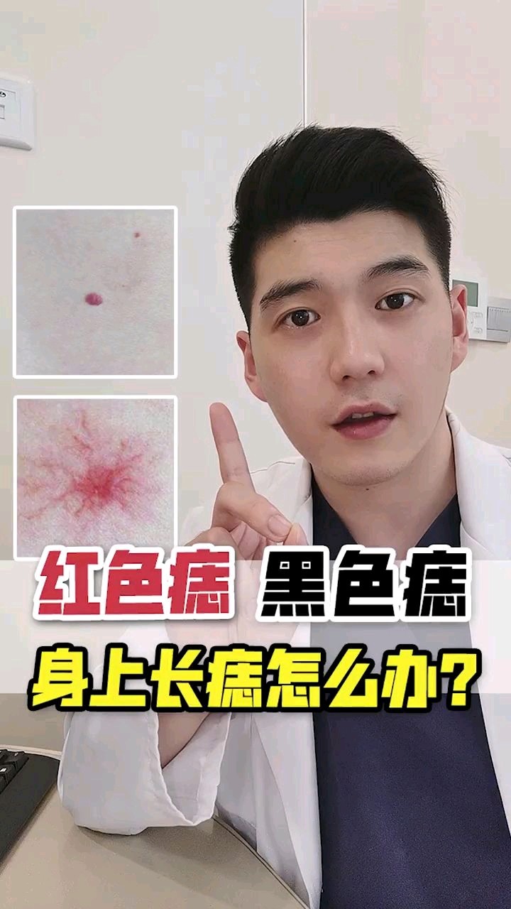 脸上身上长了_圈子-新氧美容整形