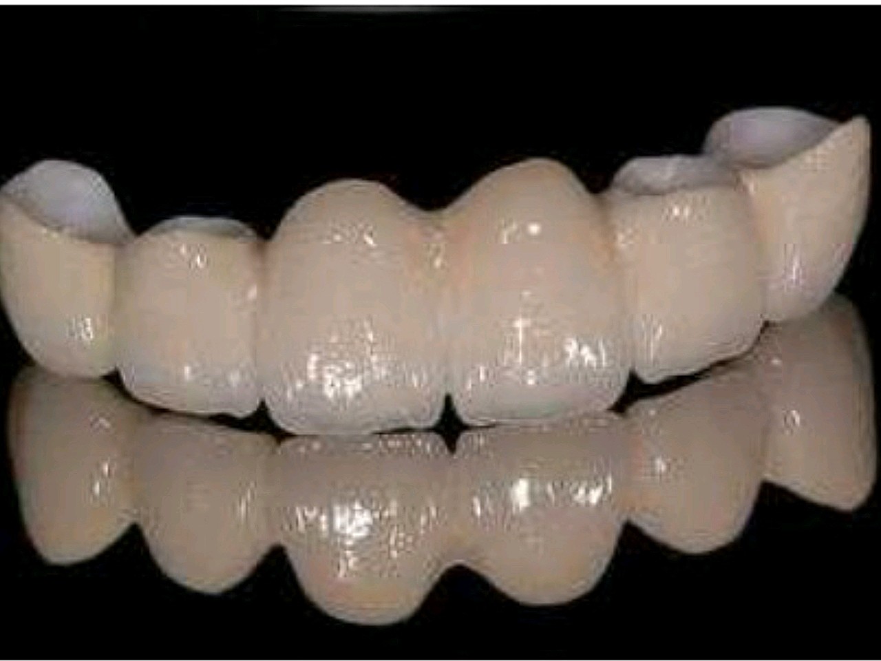 9797种植系统修复979796种植牙齿也叫人工种植牙,99并
