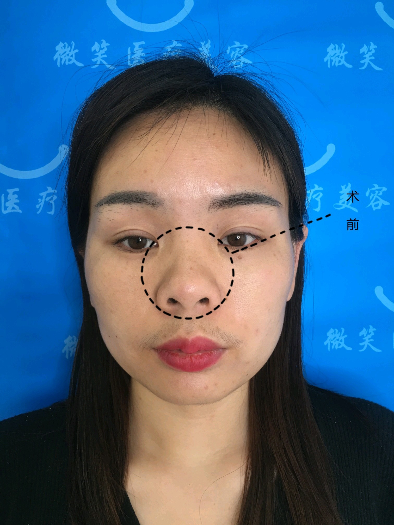 今天我们分享这位叫琴琴的女生,这位琴琴的眉眼是很