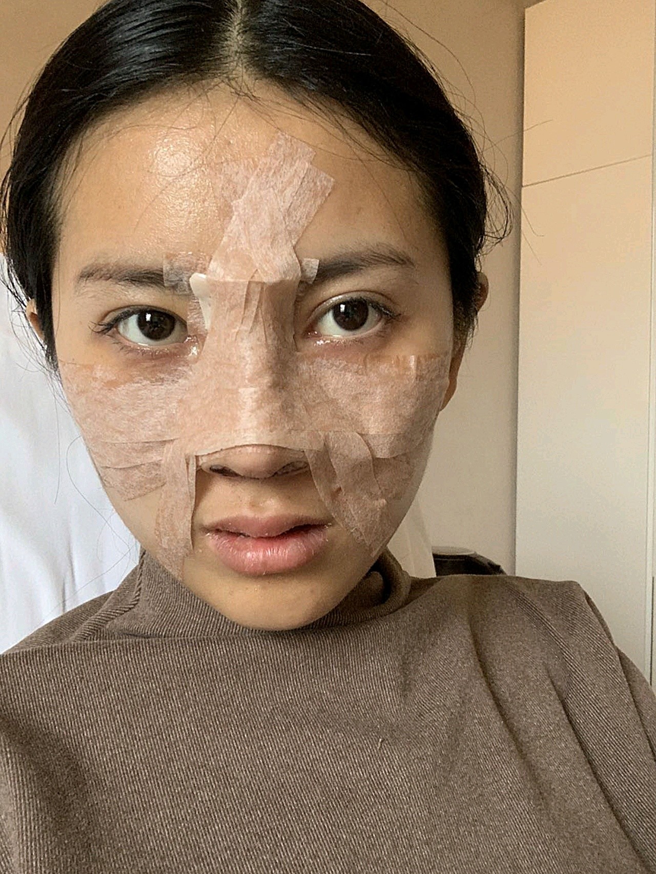 [重庆艺星 耳软骨隆鼻 第2天]