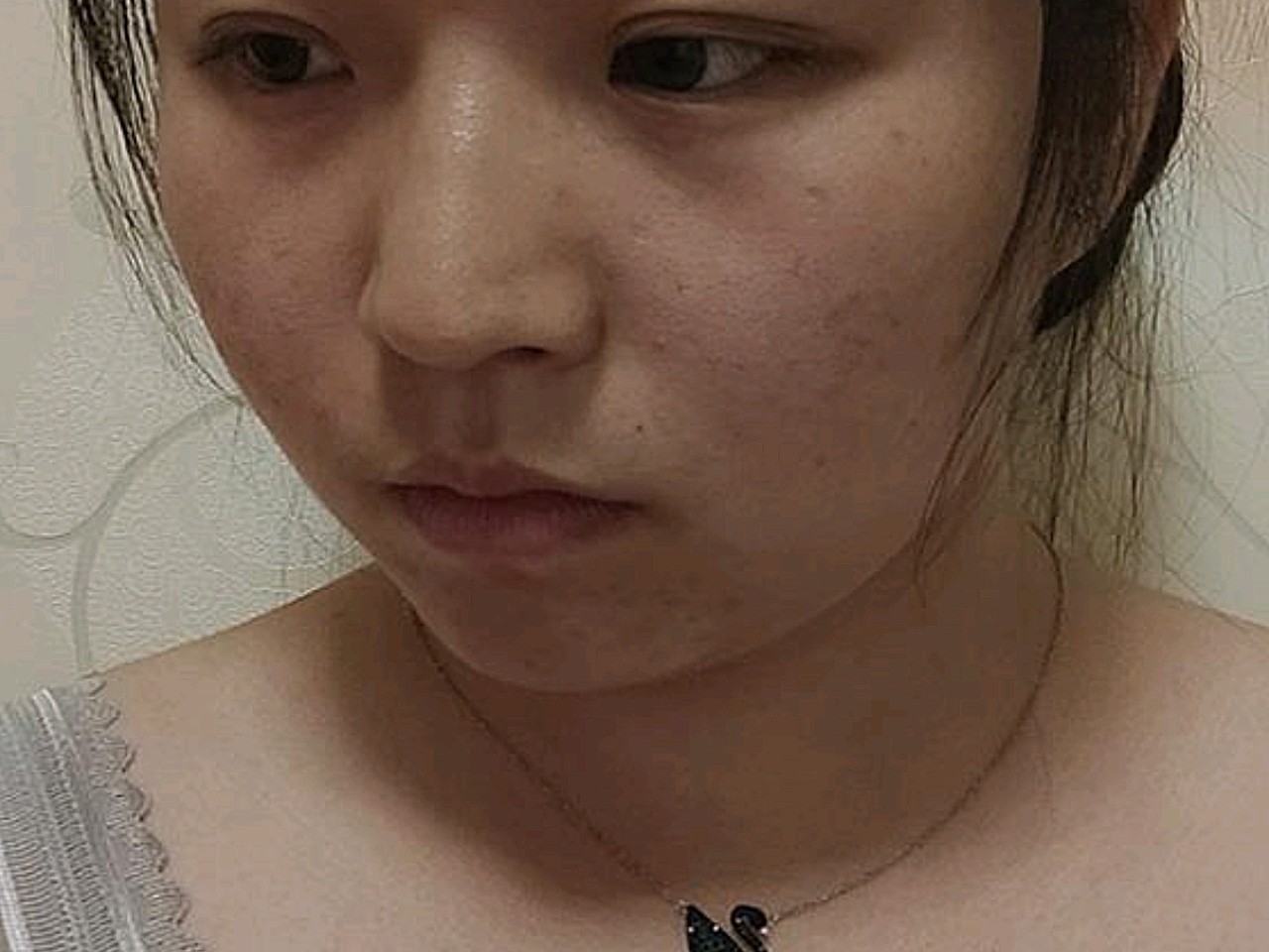 热玛吉真的很有效果脸部的紧绷是从真皮层感觉出来的就是感觉皮肤里面