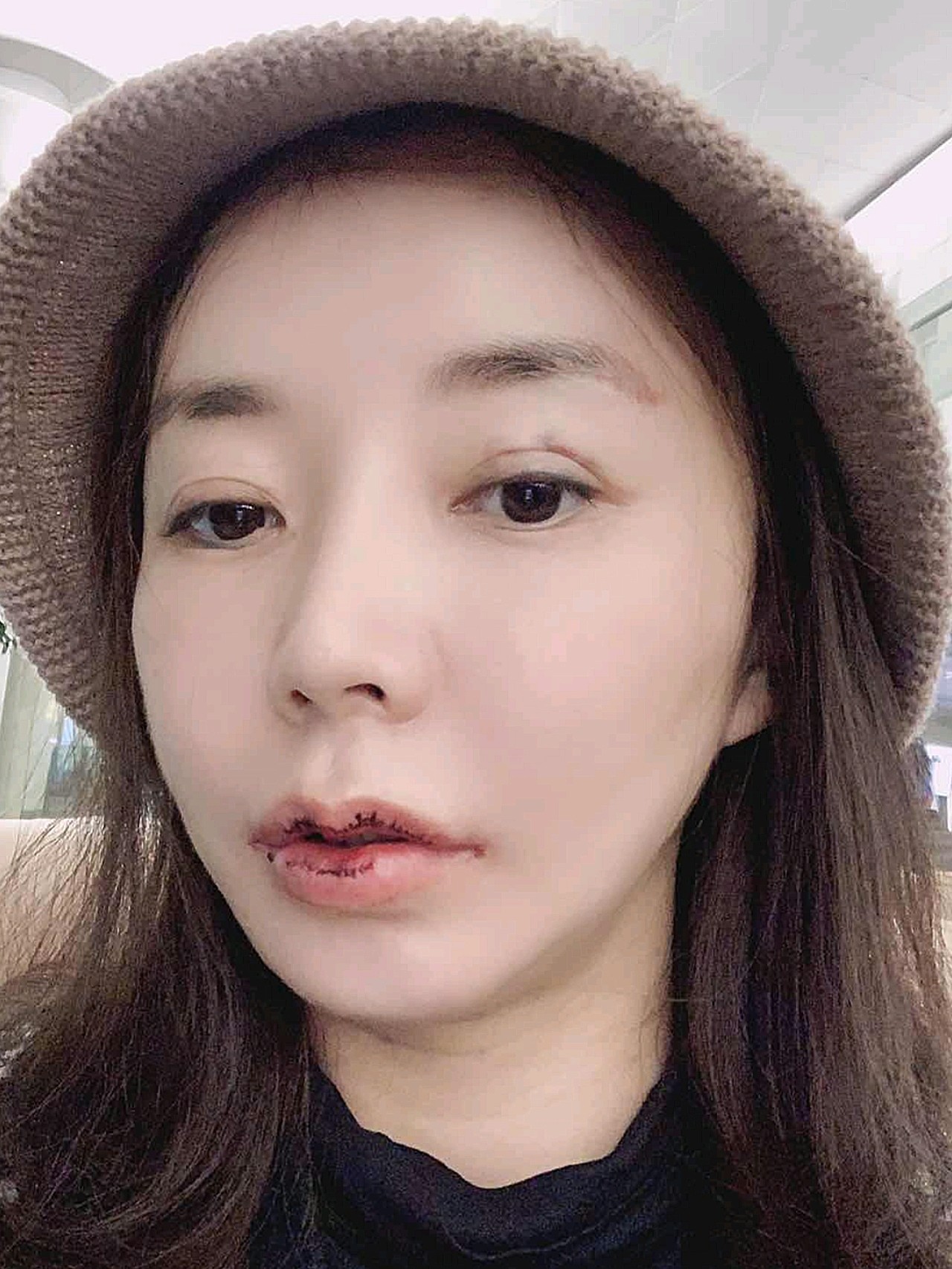 都说上唇比下唇要薄,唇部轮廓更为明显,但是我的嘴唇真的就是一点形都