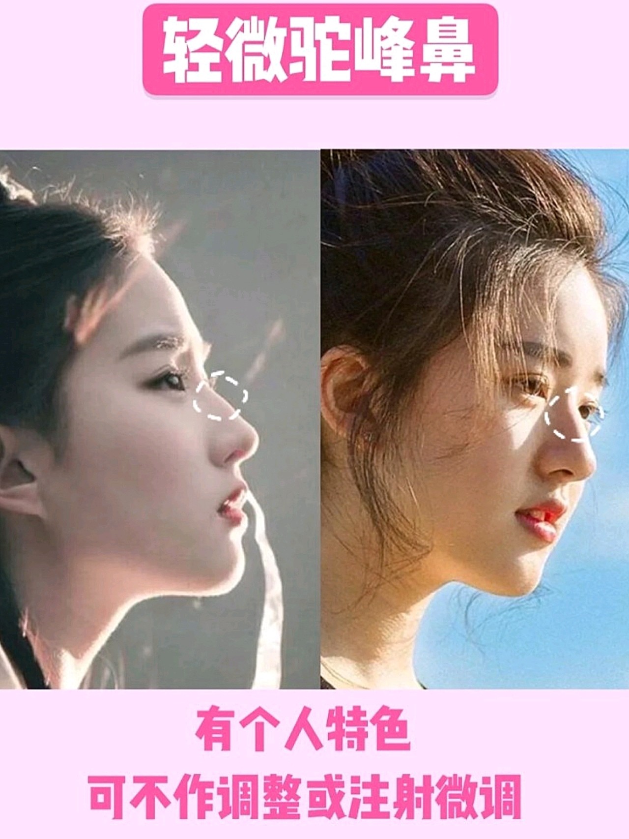 赵露思的鼻子为什么是难以复制的新模版?