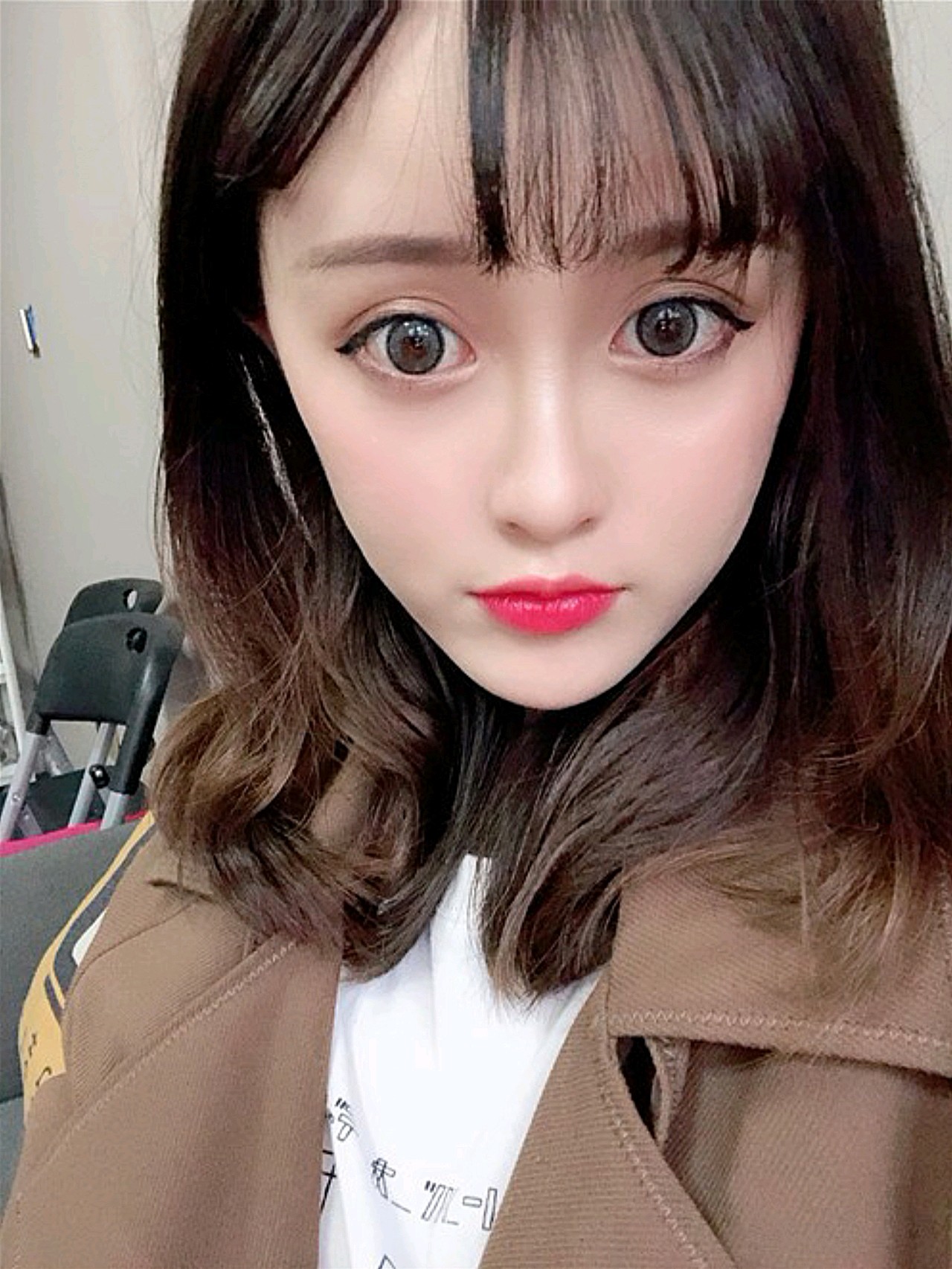 【怀化韩美-脂肪填充全脸】术后第45天