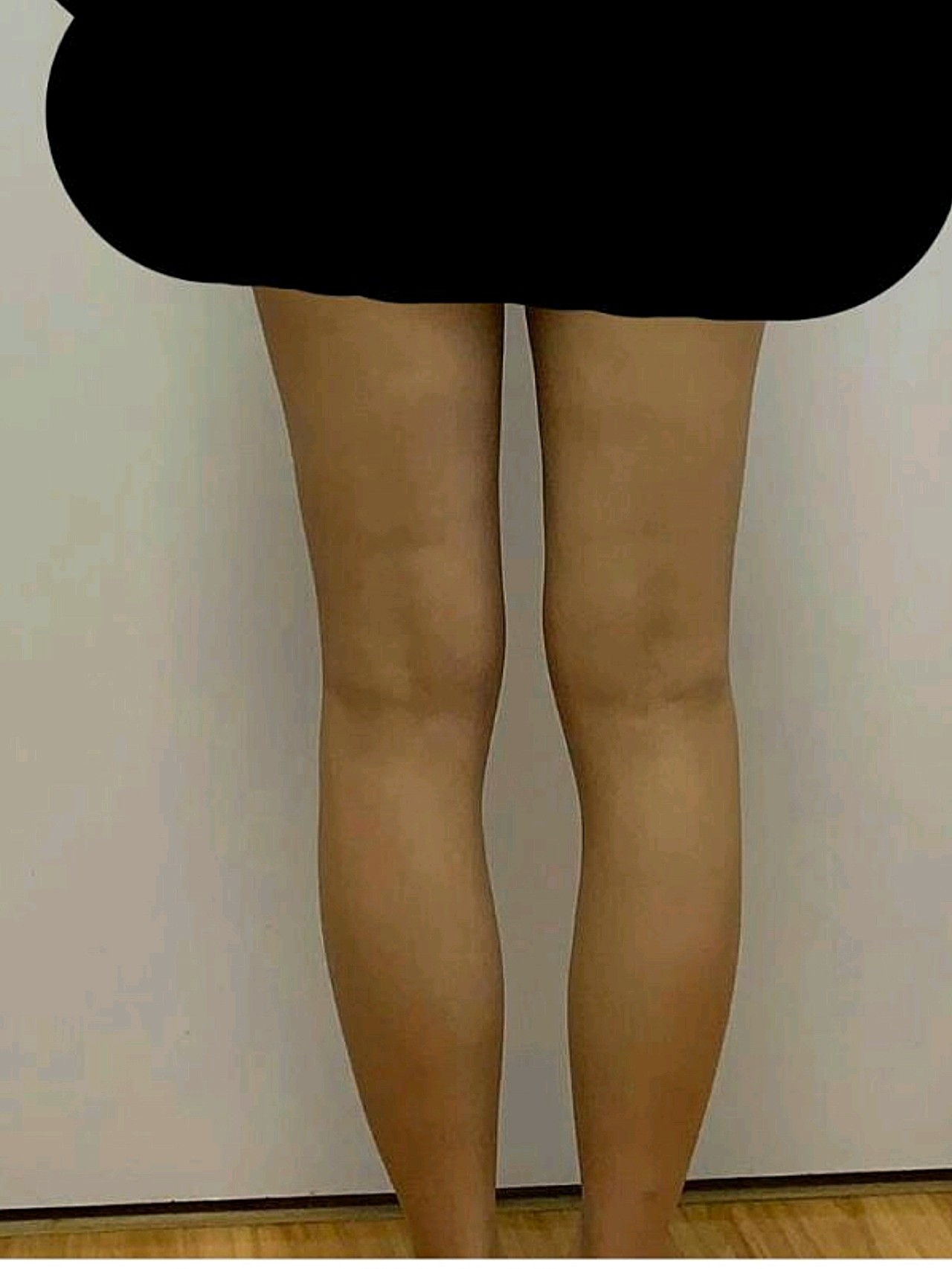 大象腿,再也不见!