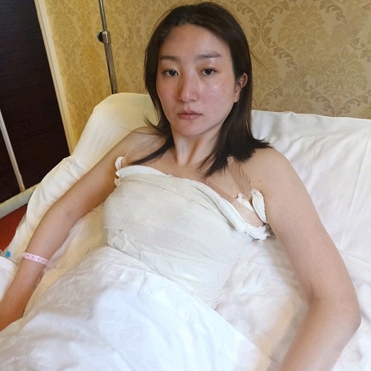 产后下垂,她们比我严重很多,因为我本身就小,前段时间她做了隆胸手术