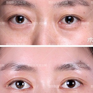 大连爱德丽格整形刘志刚发表文章_用户案例-新氧-专业医美服务平台