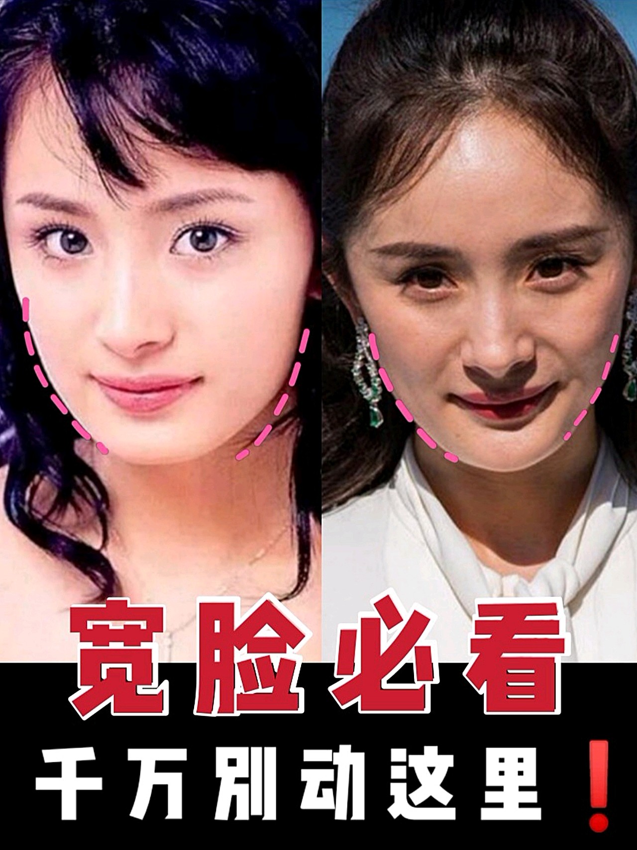 千万别动这里!嫩牛五方脸?宽下颌?其实它_圈子-新氧美容整形