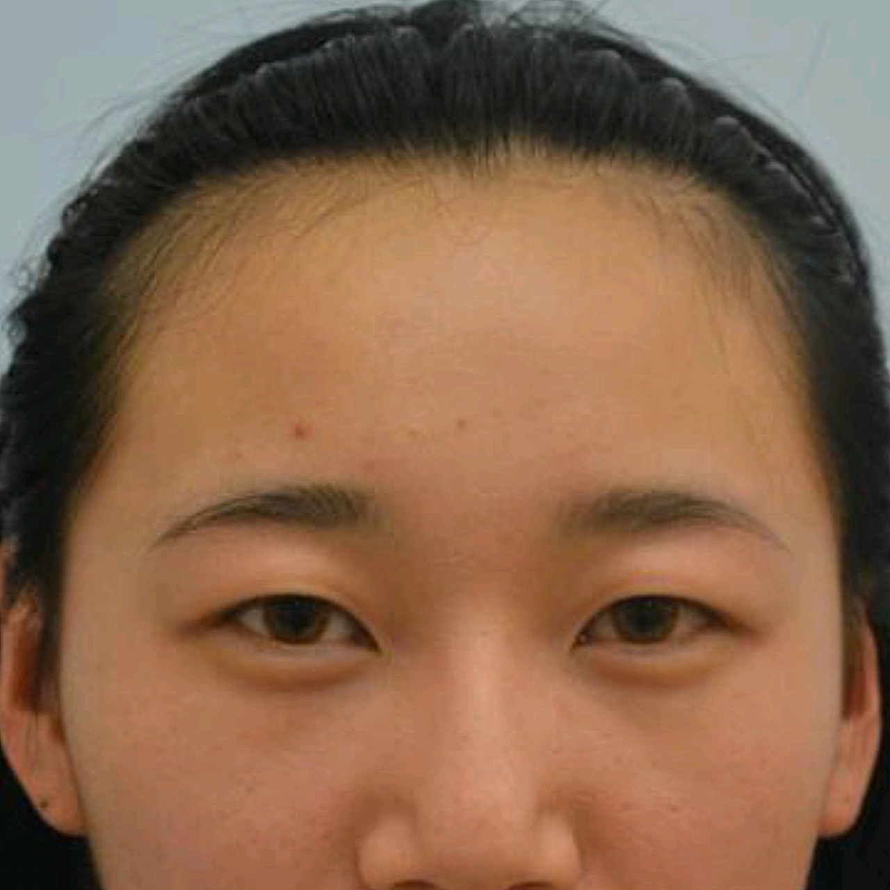 【面诊沟通】因为我眼皮很厚,平时基本上自己画眼线要_圈子-新氧美容