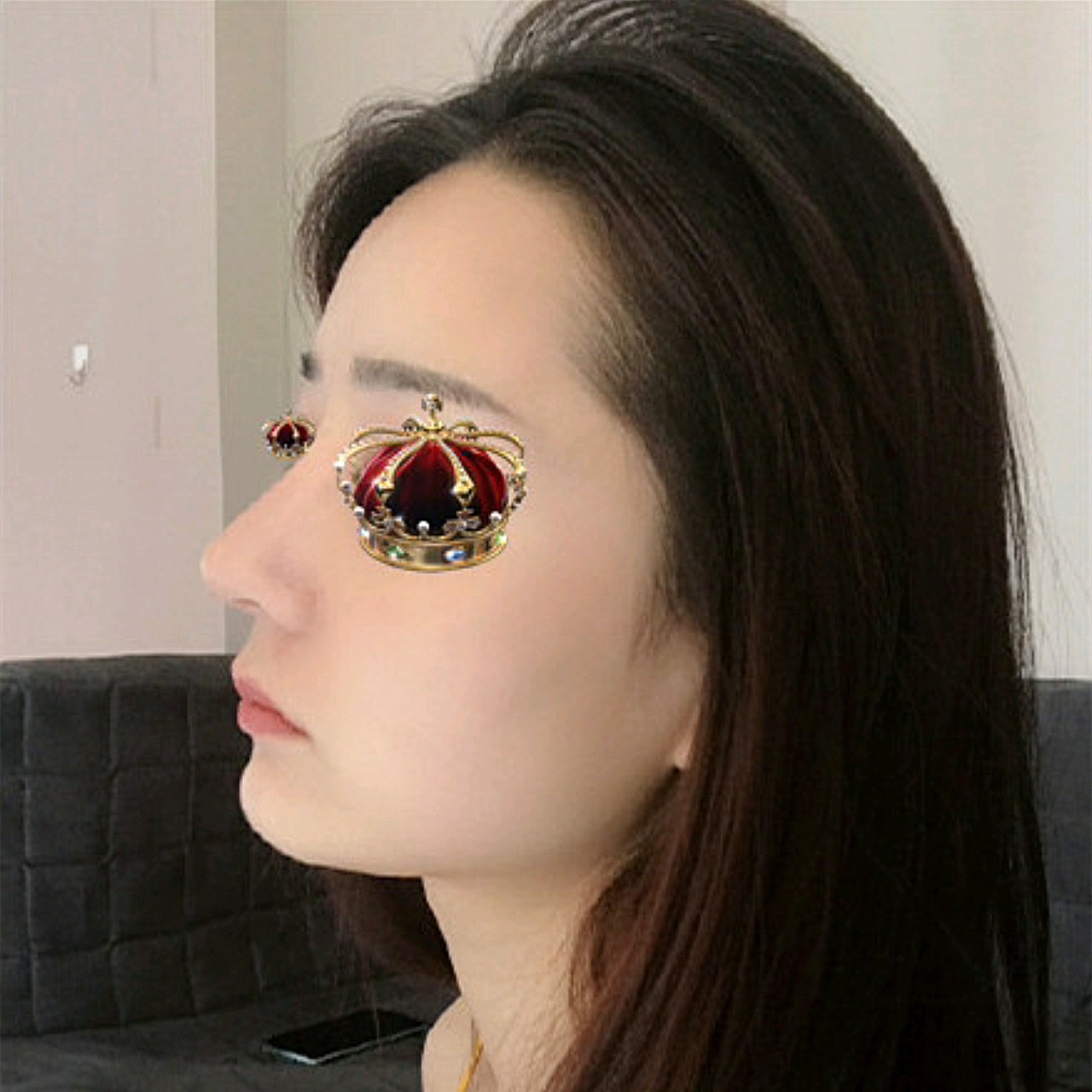 高挺翘的鼻子,和我预期的一模一样,自然又不夸张,很_圈子-新氧美容