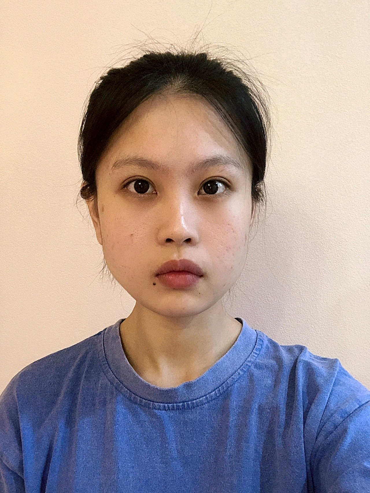 我主要是下半张脸肉肉松得很明显,做完之后明显感觉有_圈子-新氧美容